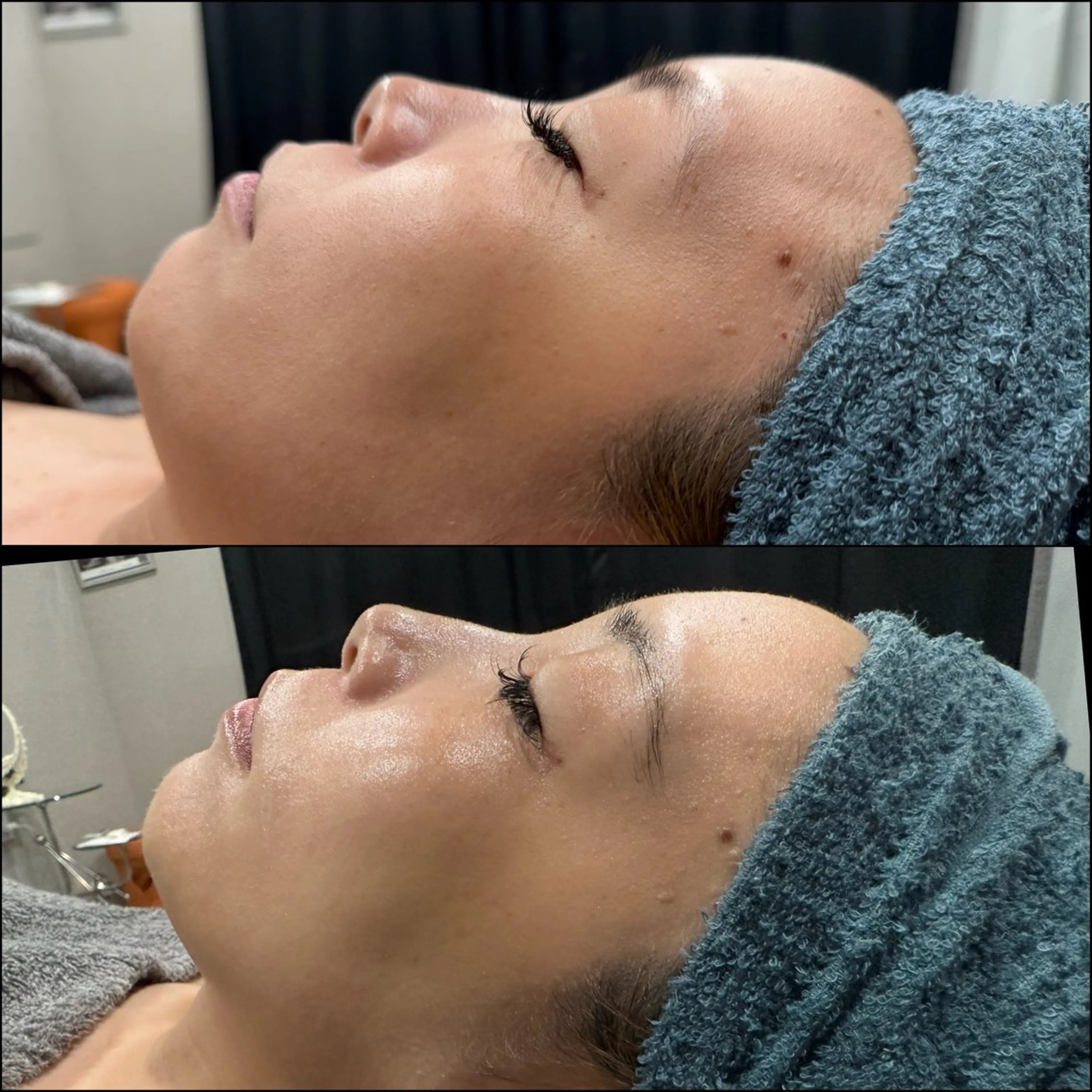 エステ LiZA エステティックサロンのエステ・リラクイメージ