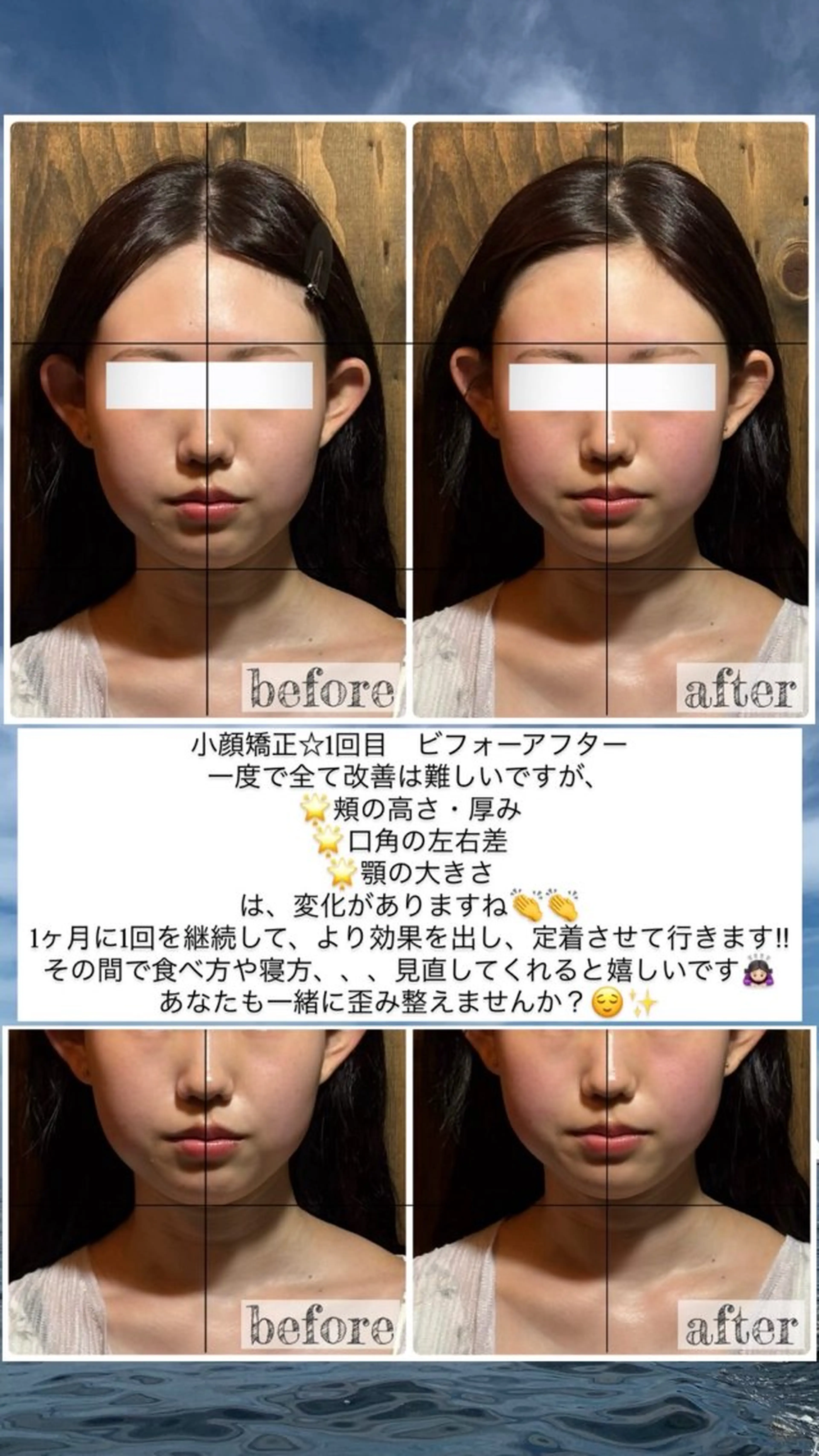 エステ リラク 💎後悔させない小顔 矯正💎イトヤマ🌱のエステ・リラクイメージ