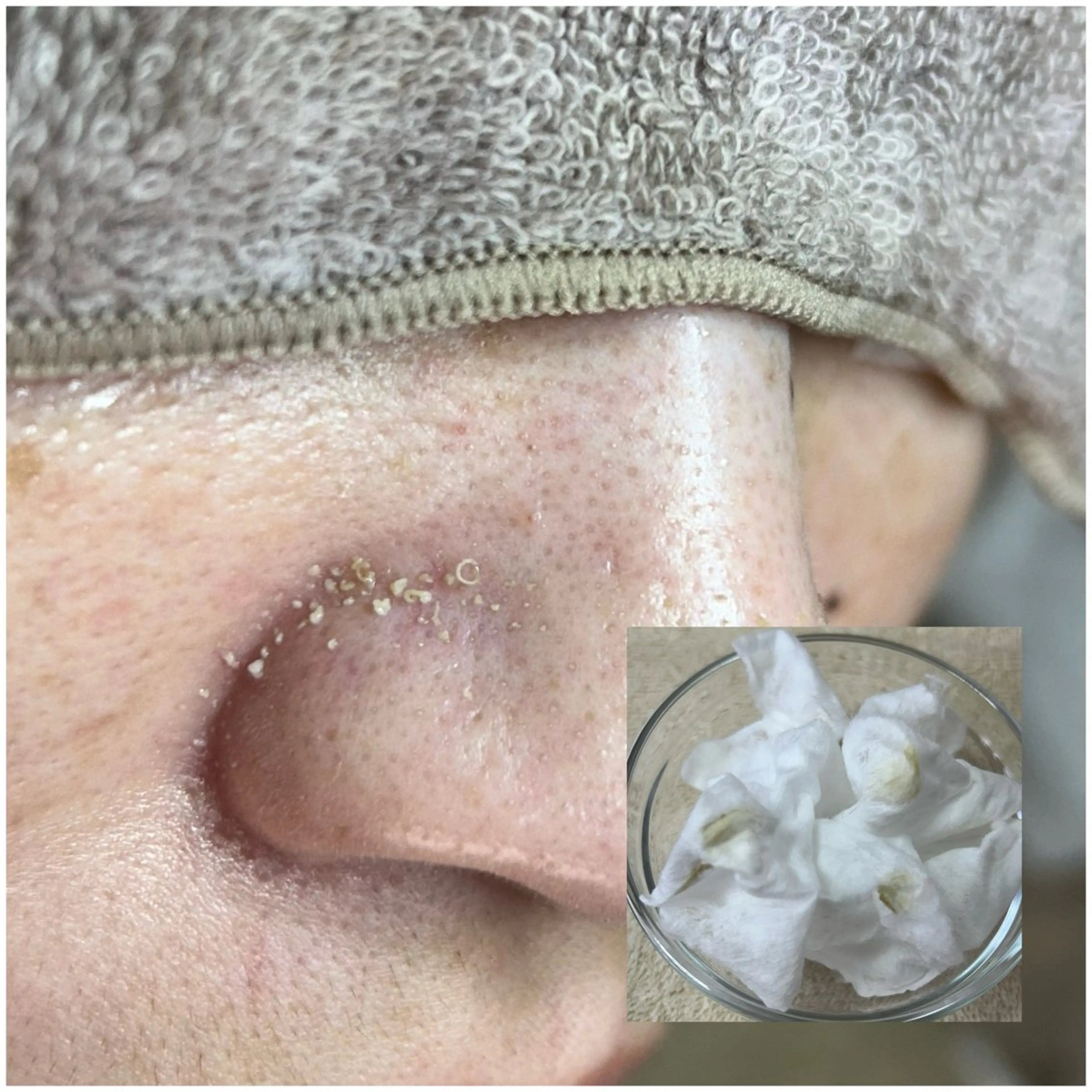 毛穴洗浄専門店/ 泉佐野/oluoluのエステ・リラクイメージ