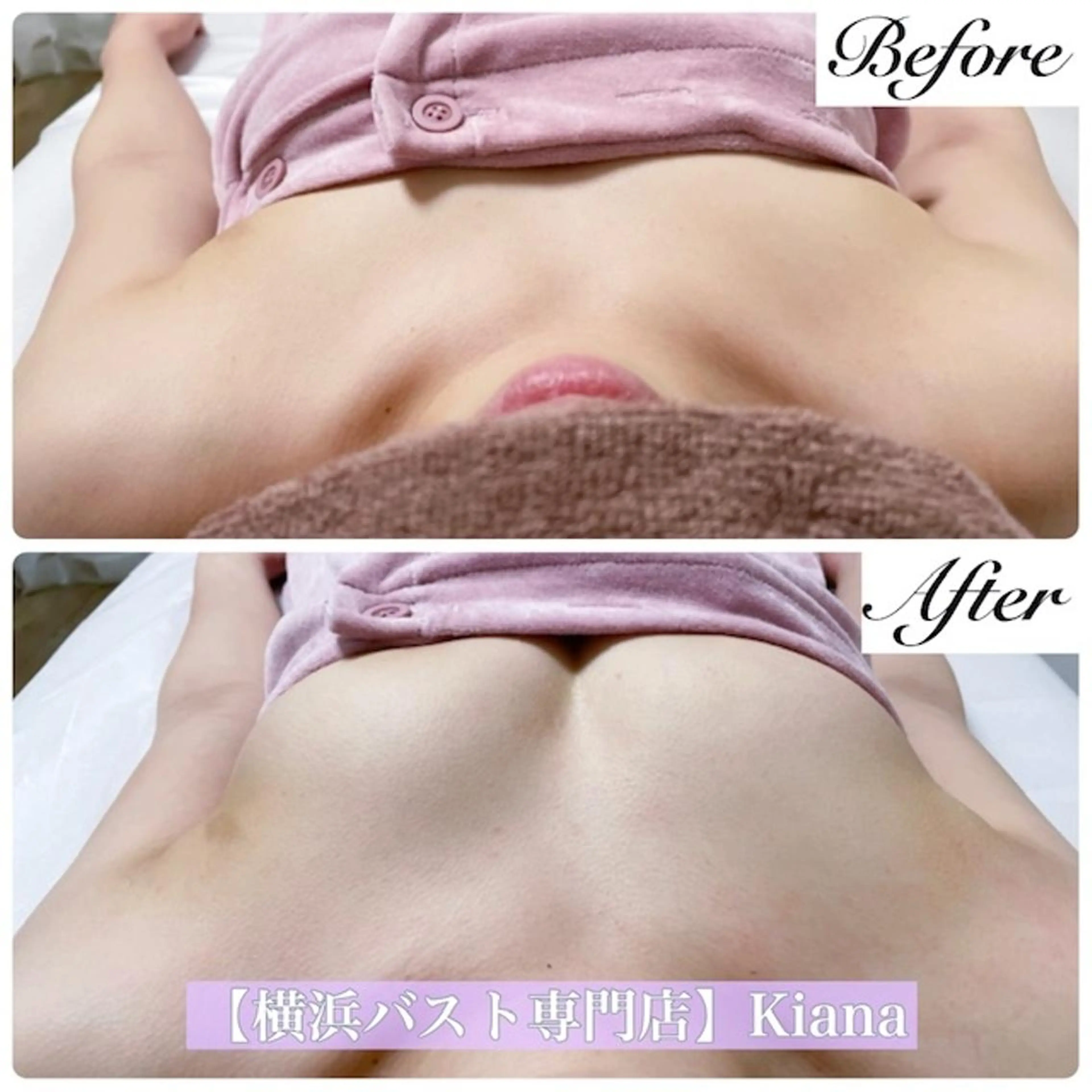 お手軽バストアップ施術50分　¥11000→¥5500の写真