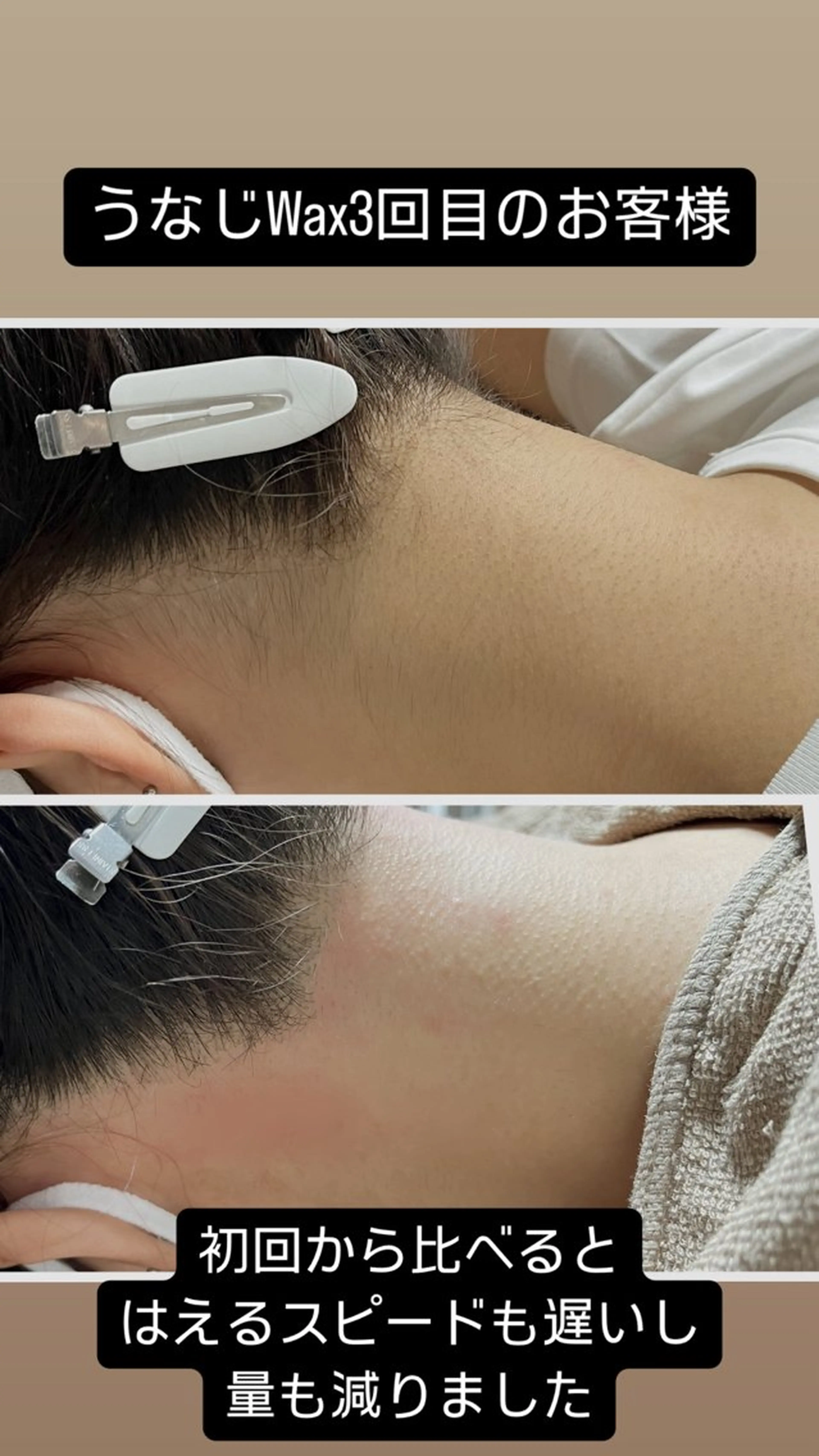 脱毛 B&H所属・頭痛•肩こり専門/ 眉サロンB&H心斎橋のエステ・リラクイメージ