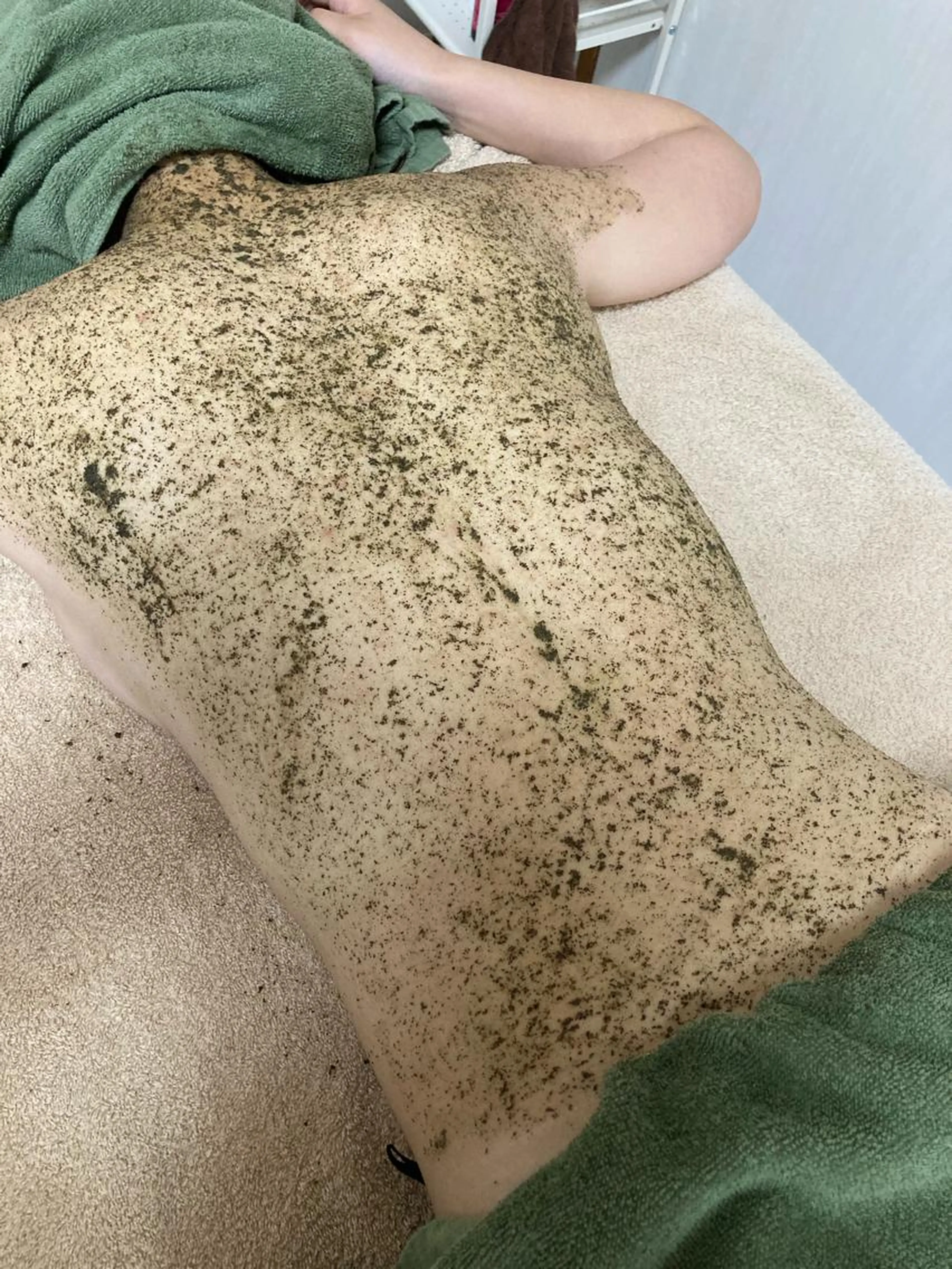 背中美人💖陶肌トリートメント背中(上部)🧖‍♀️🌿しつこいニキビ、ニキビ跡、色素沈着を改善✨の写真