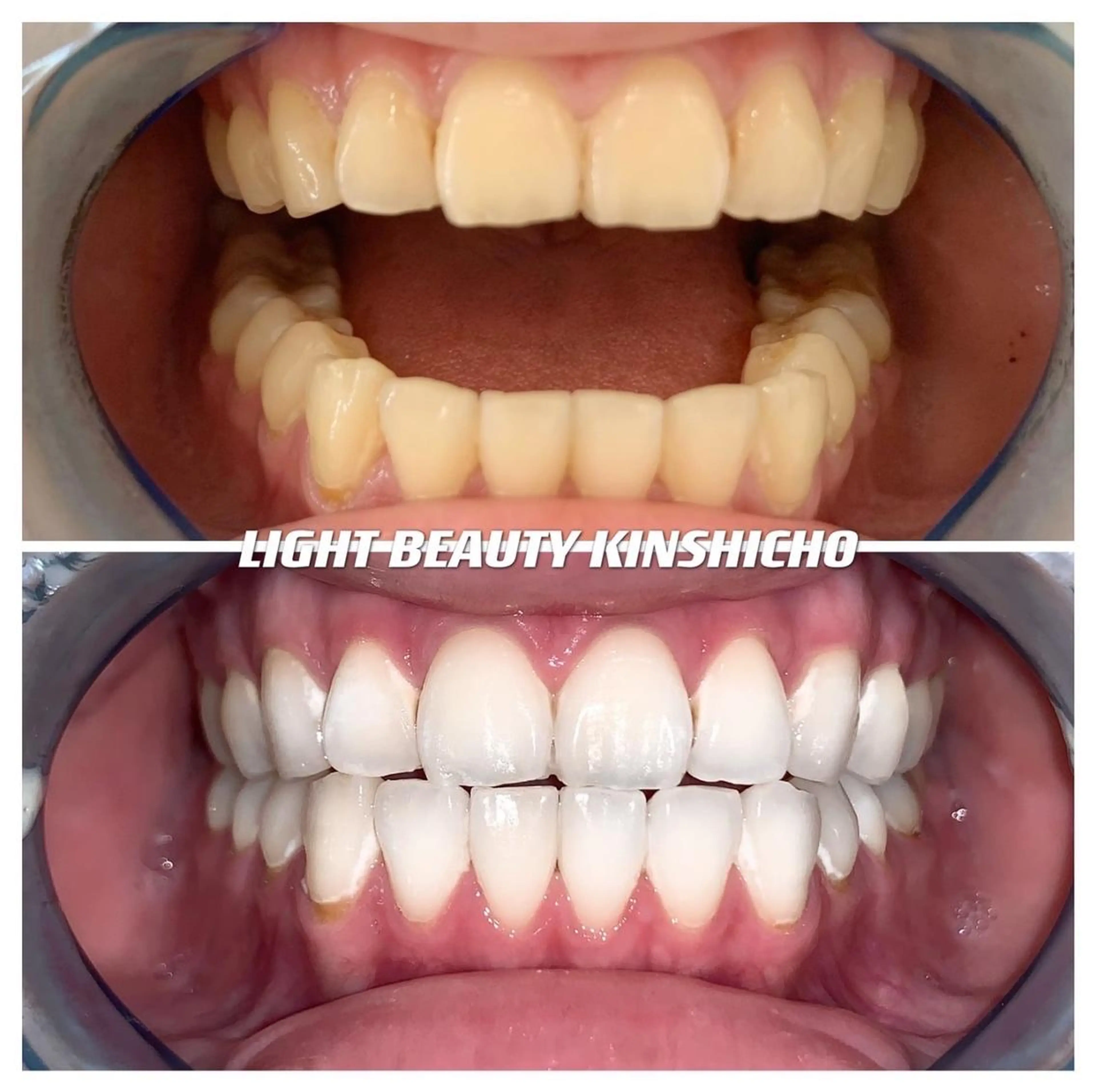 メンズ ライトビューティー 錦糸町店のエステ・リラクイメージ