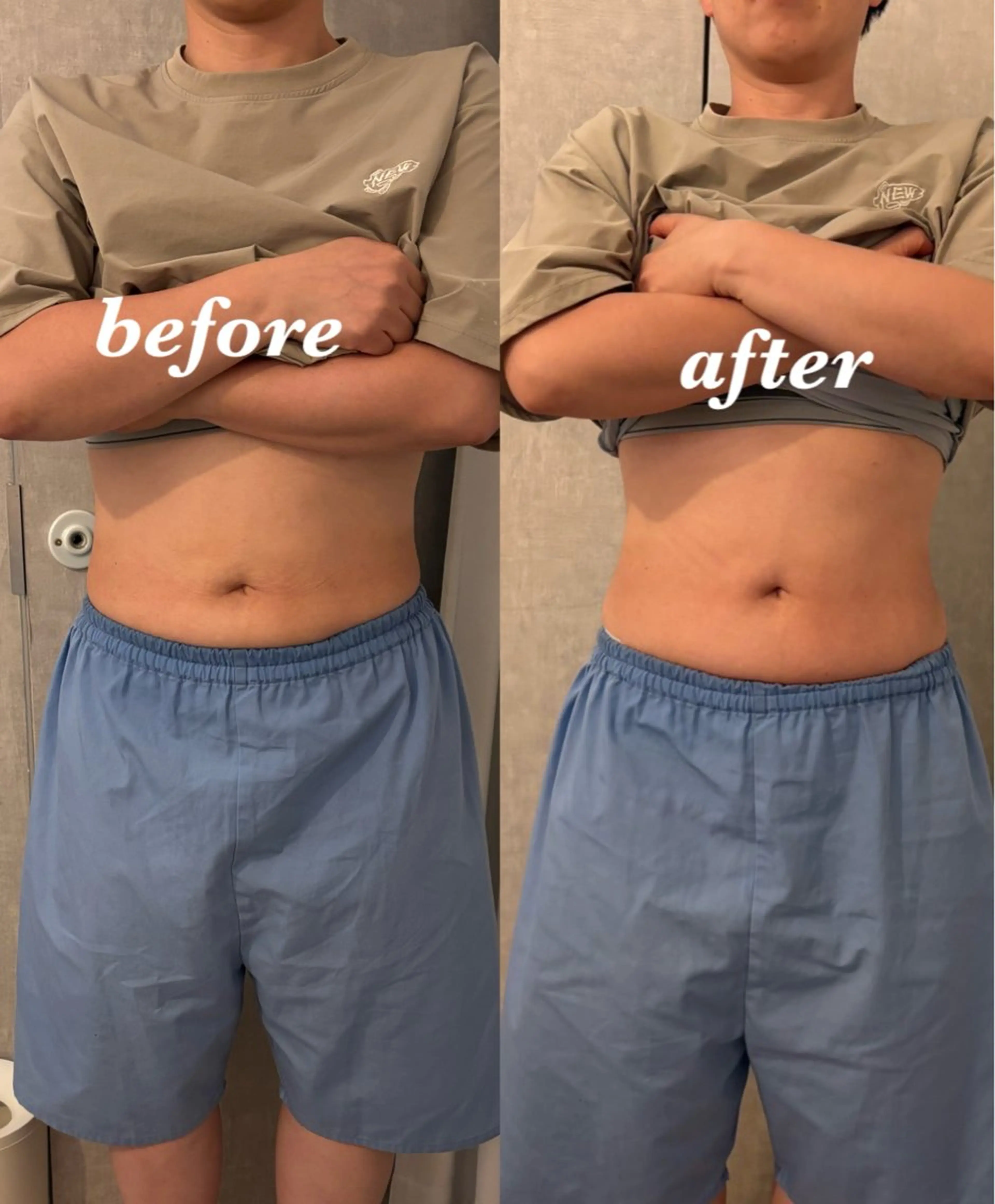 その他 腸活サポート みなみののエステ・リラクイメージ