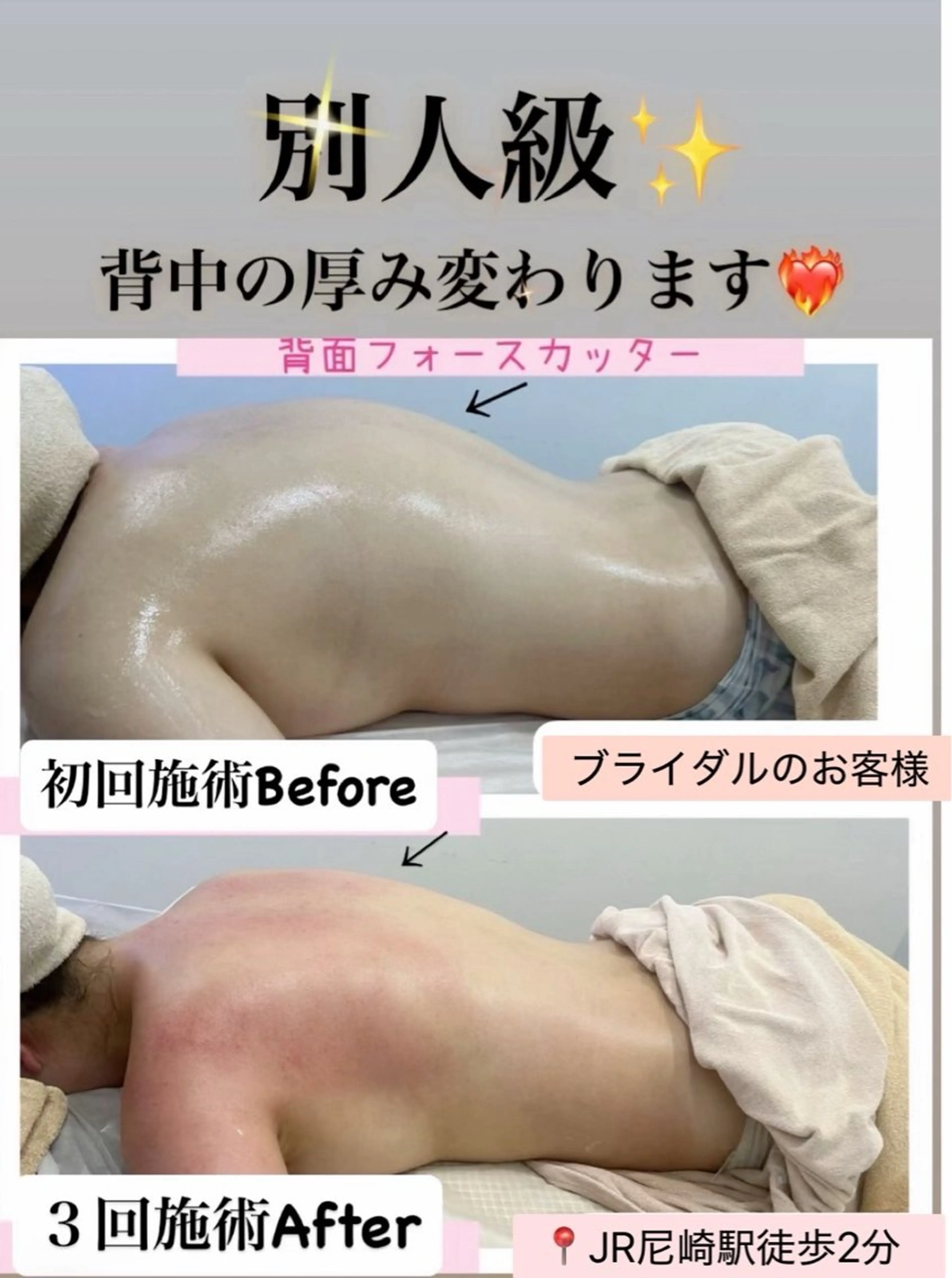 エステ ブライダル痩身×脱毛 尼崎駅前サロンのエステ・リラクイメージ