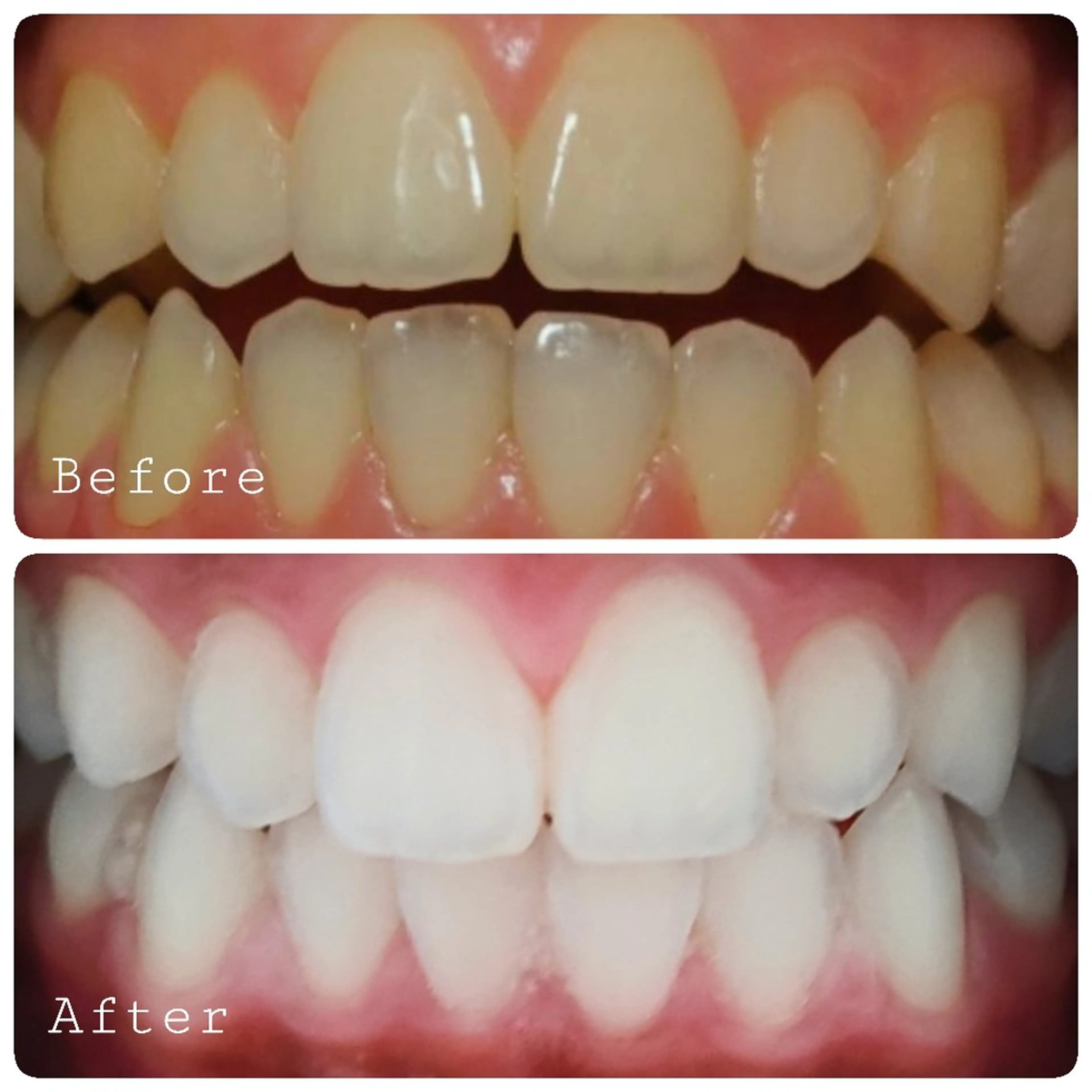 ほわいと あざぶのマツエク・マツパデザイン