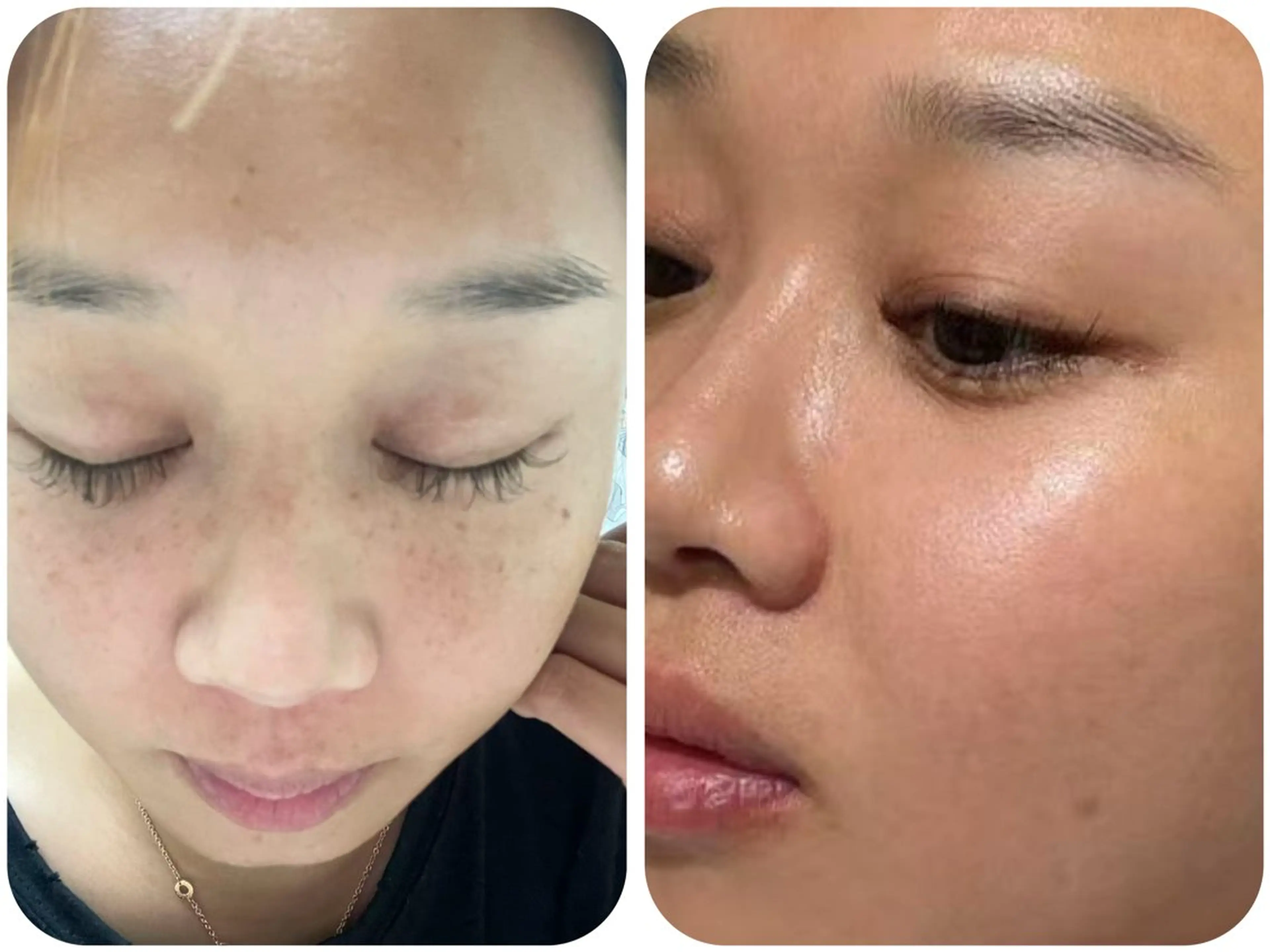 エステ エムズ ビューティスタジオのエステ・リラクイメージ