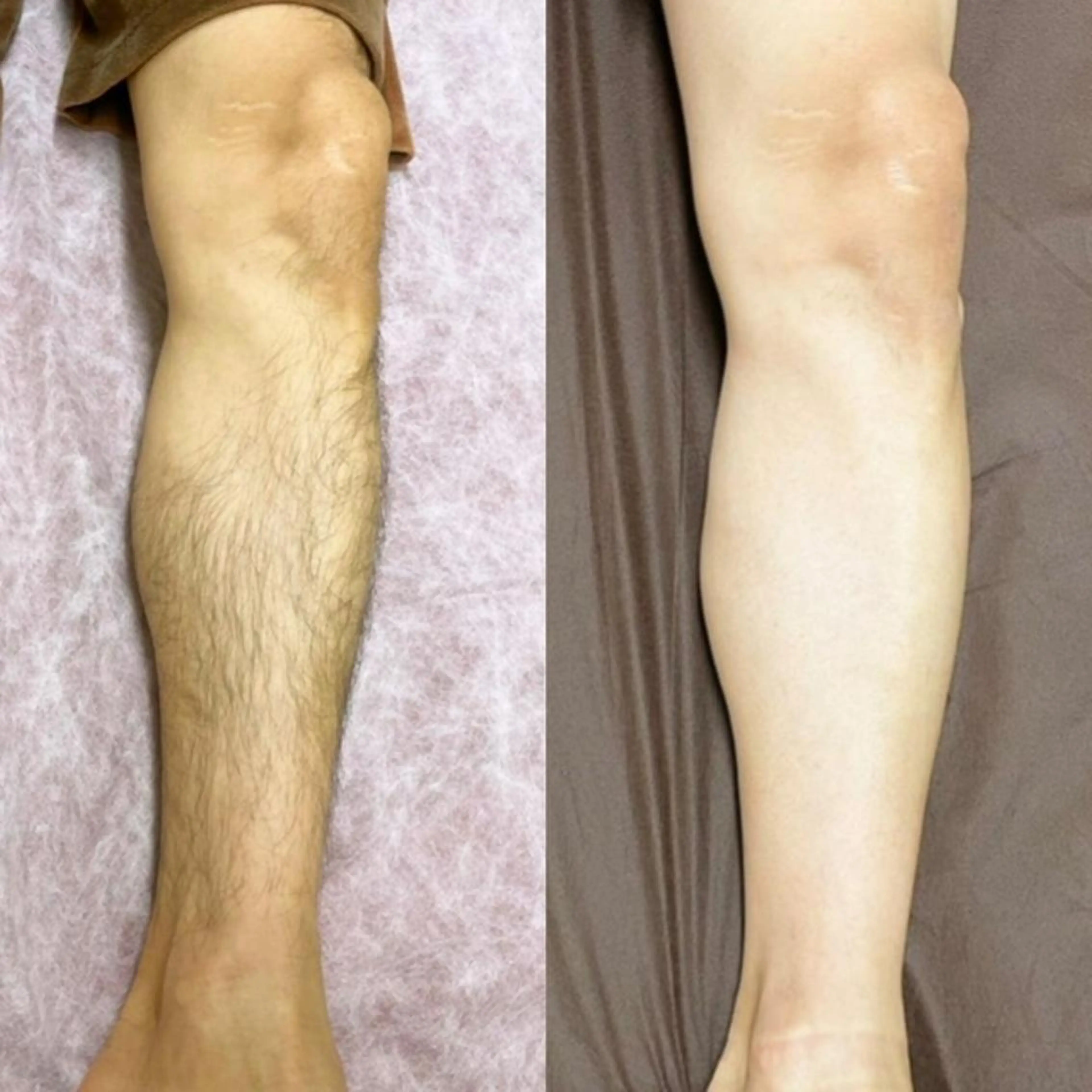 メンズ 脱毛 メンズビューティー 池村哲雄のエステ・リラクイメージ