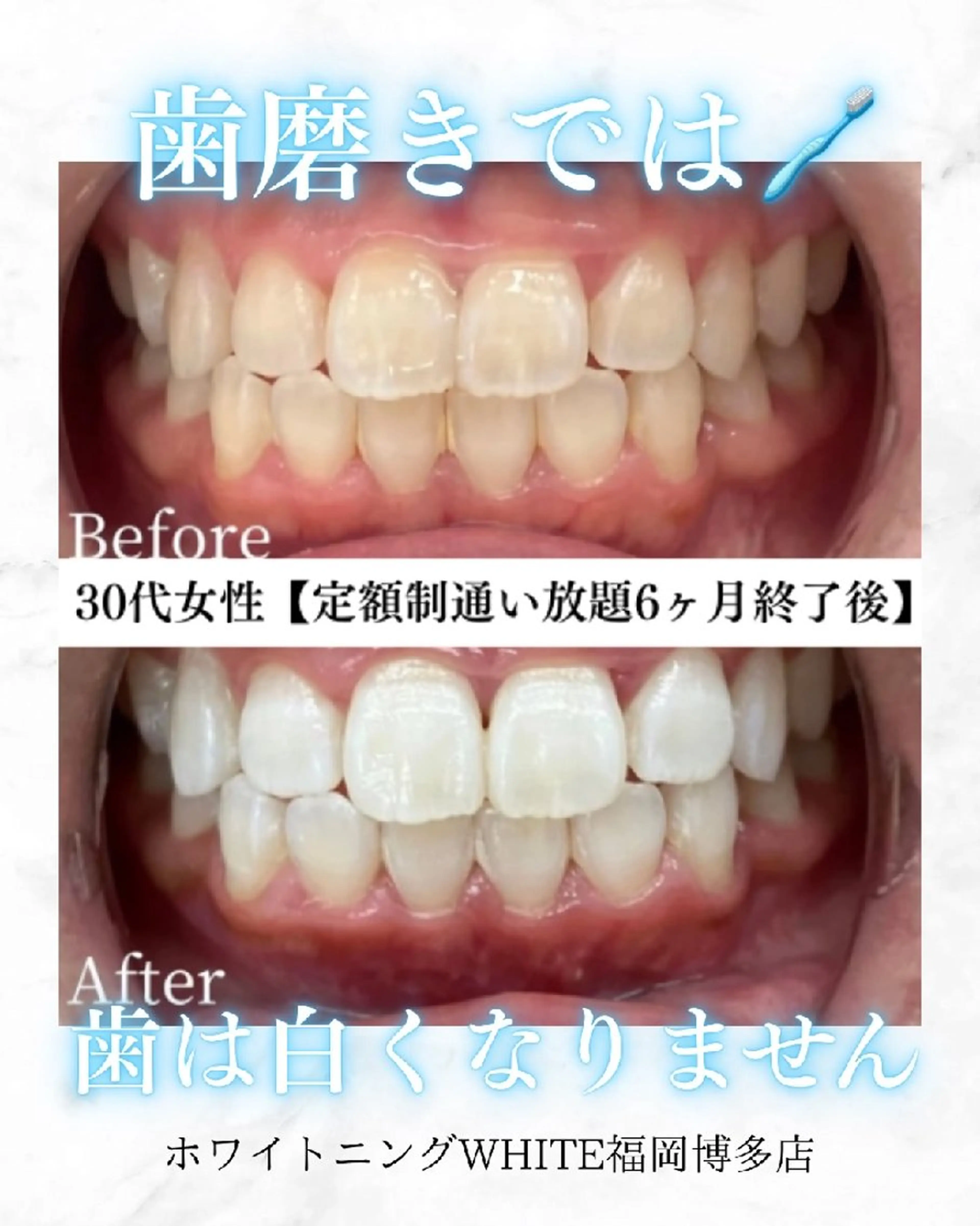 キッズ メンズ エステ リラク ホワイトニングサロン WHITE福岡博多店のエステ・リラクイメージ