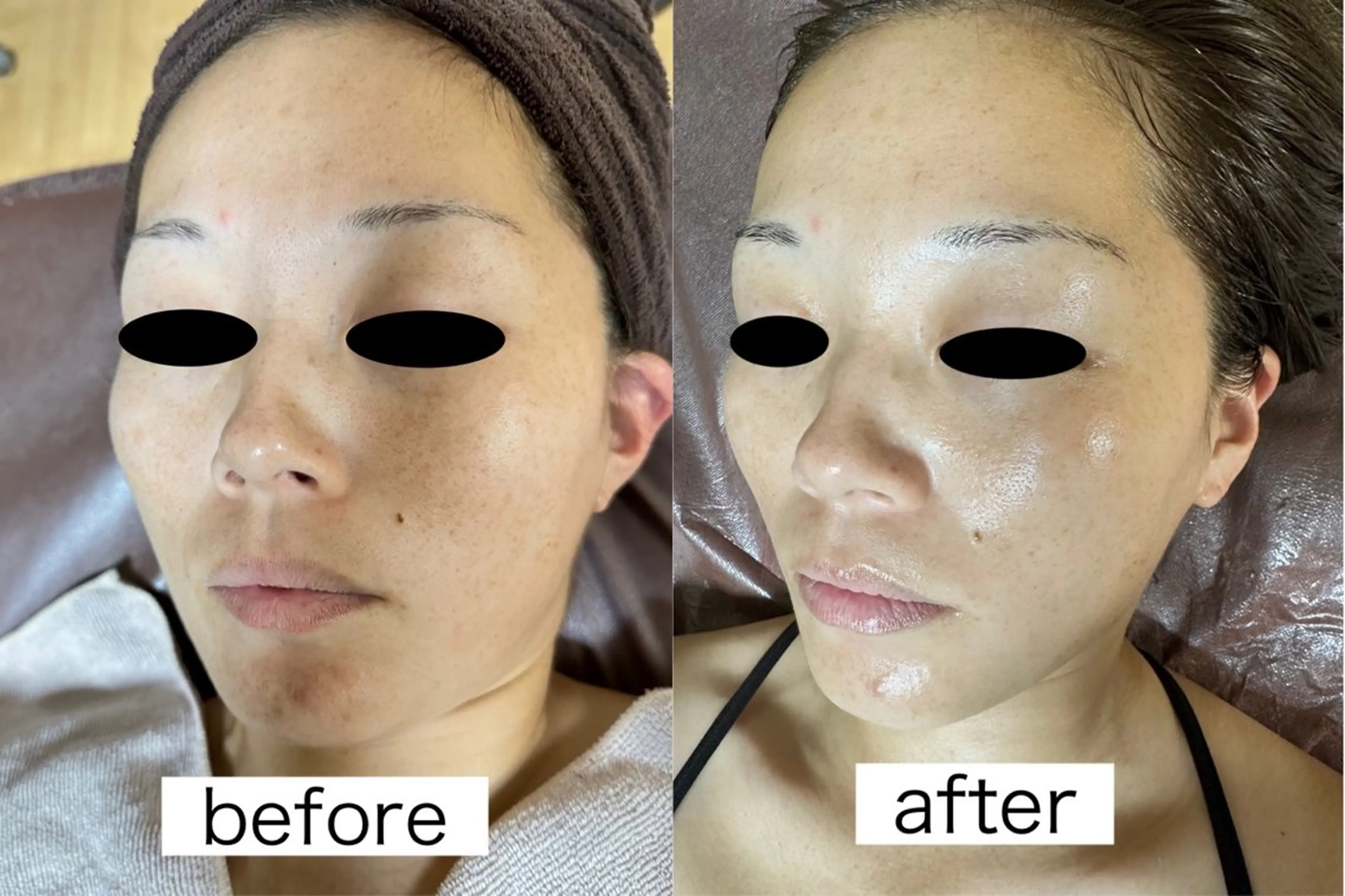 医療提携Beauty SalonMuseのエステ・リラクイメージ