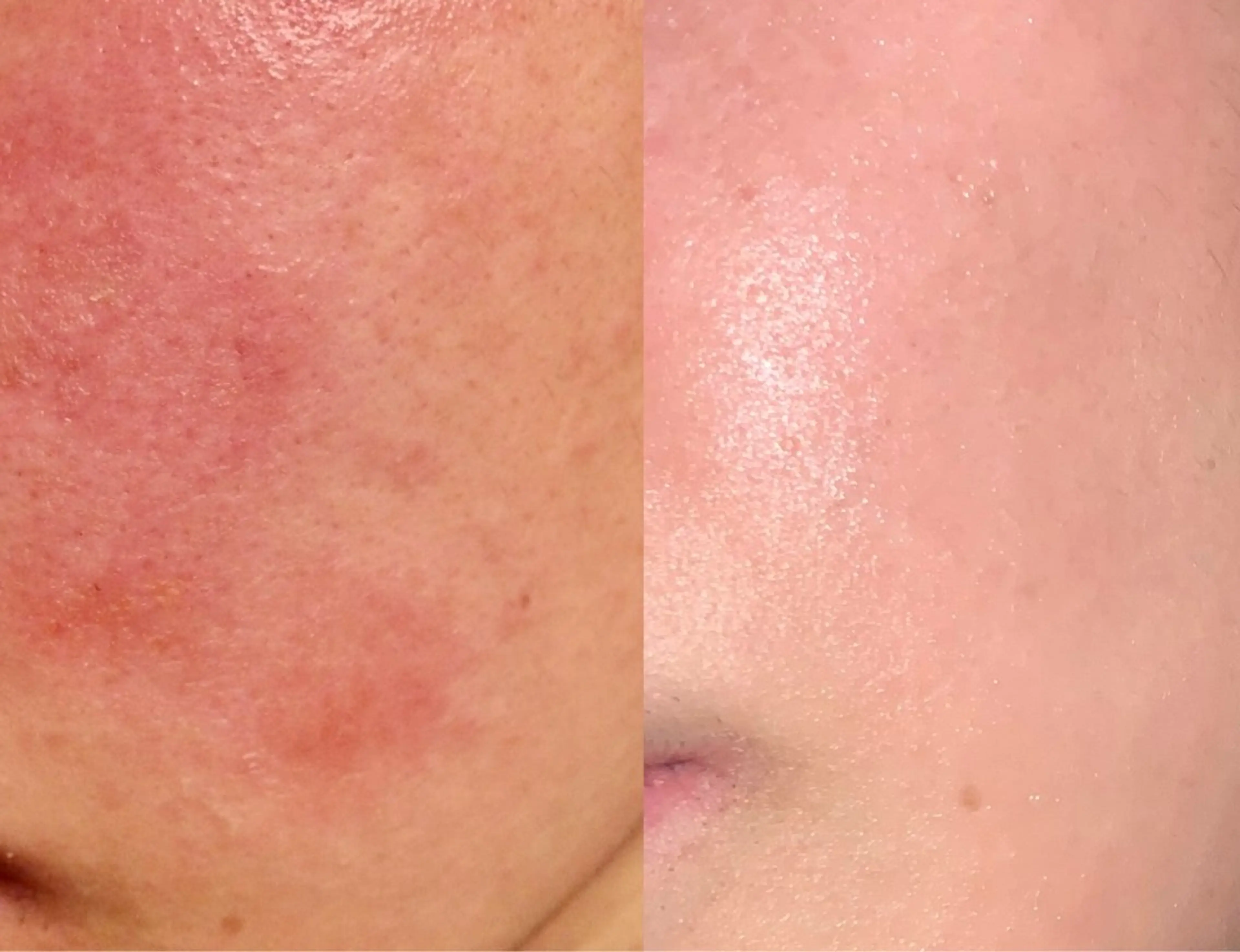 エステ SKIN SKINのエステ・リラクイメージ