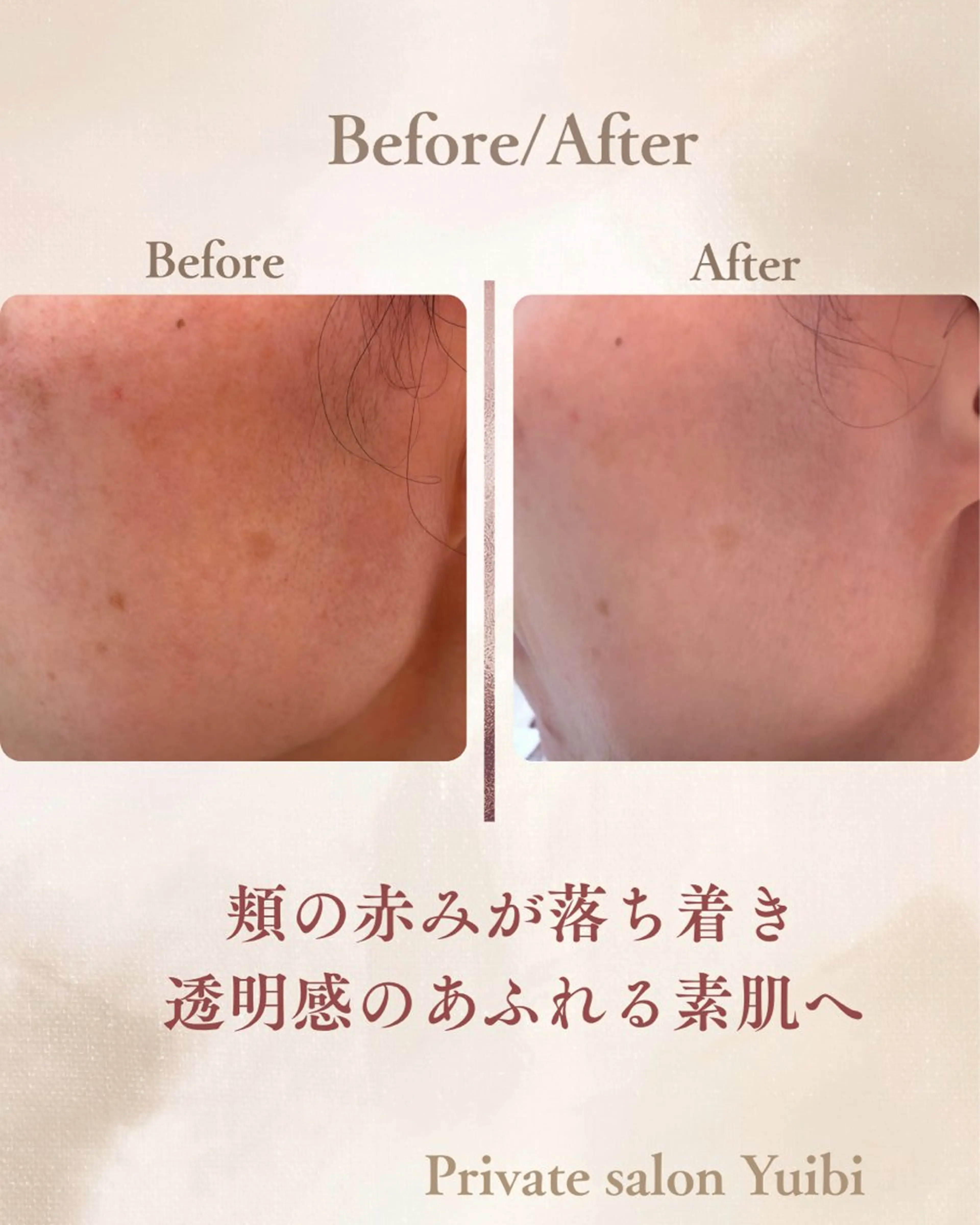 【先着5名・半額】敏感肌でも潤いツヤ肌✨はじめてフェイシャル(60分)アロマ香るマッサージ付の写真