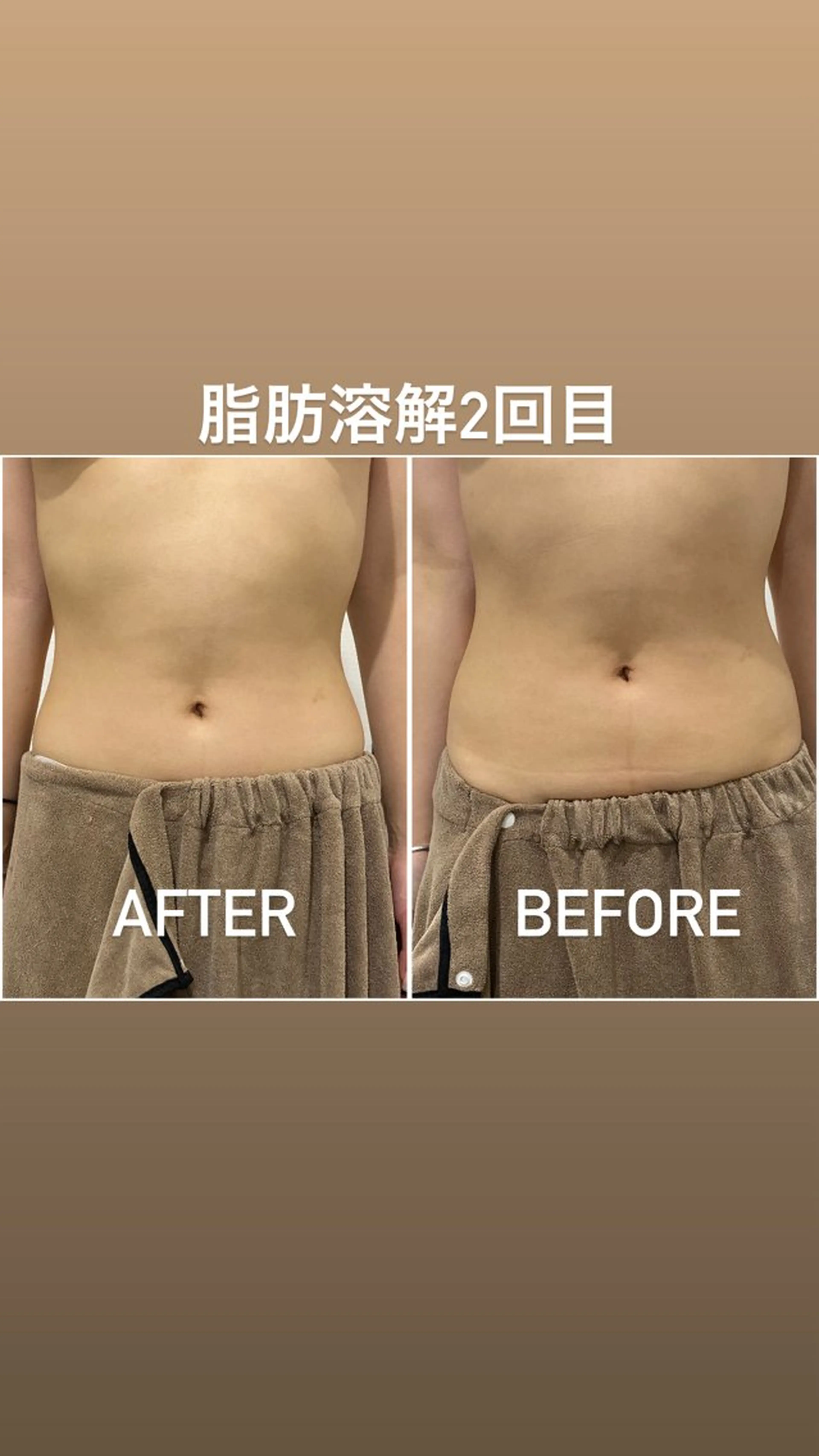 エステ 毛穴洗浄・痩身・脱毛 /アルカンジュのエステ・リラクイメージ