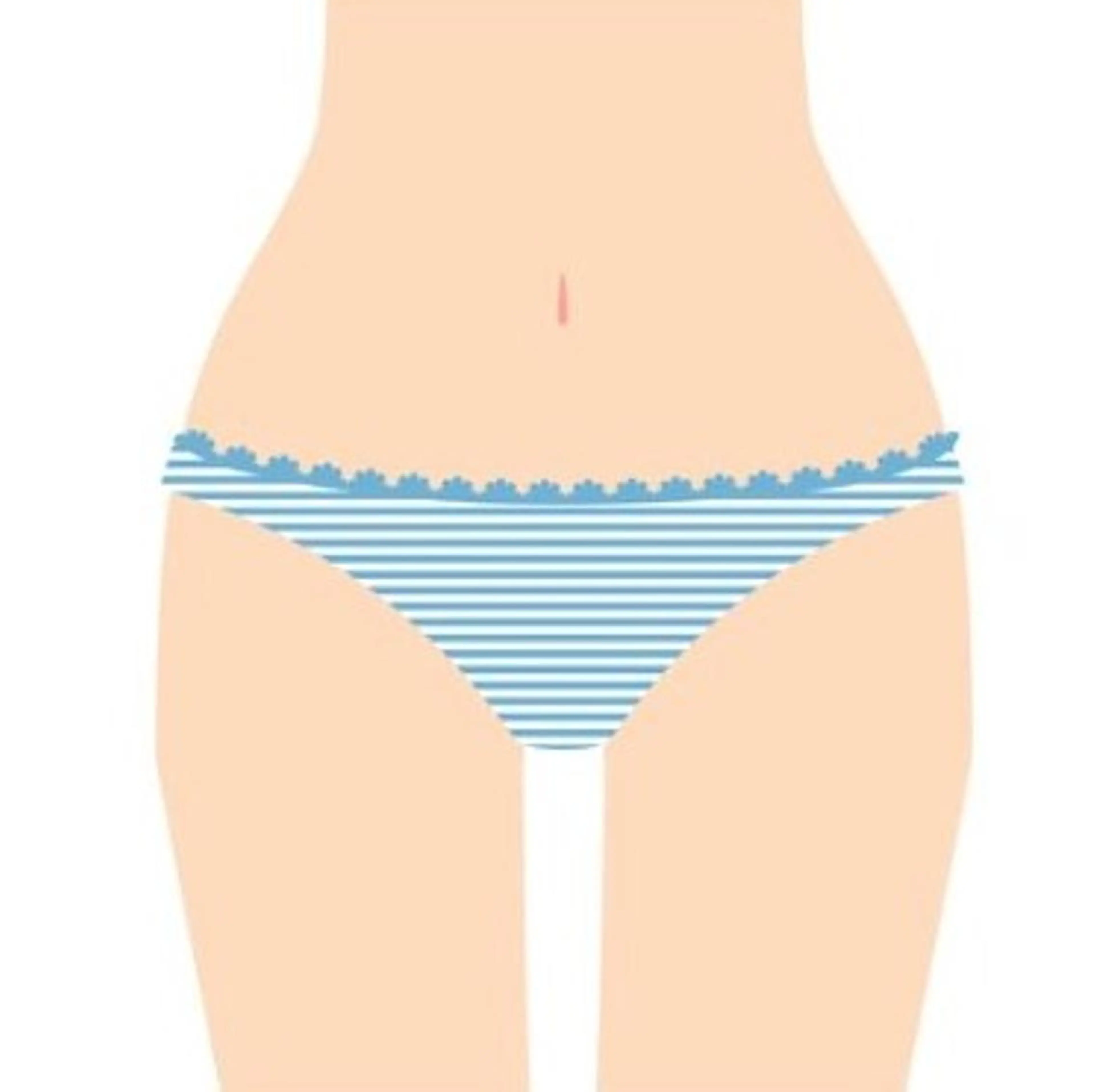 ●初回限定●VIO脱毛 60分￥6600 ※女性の方限定の写真