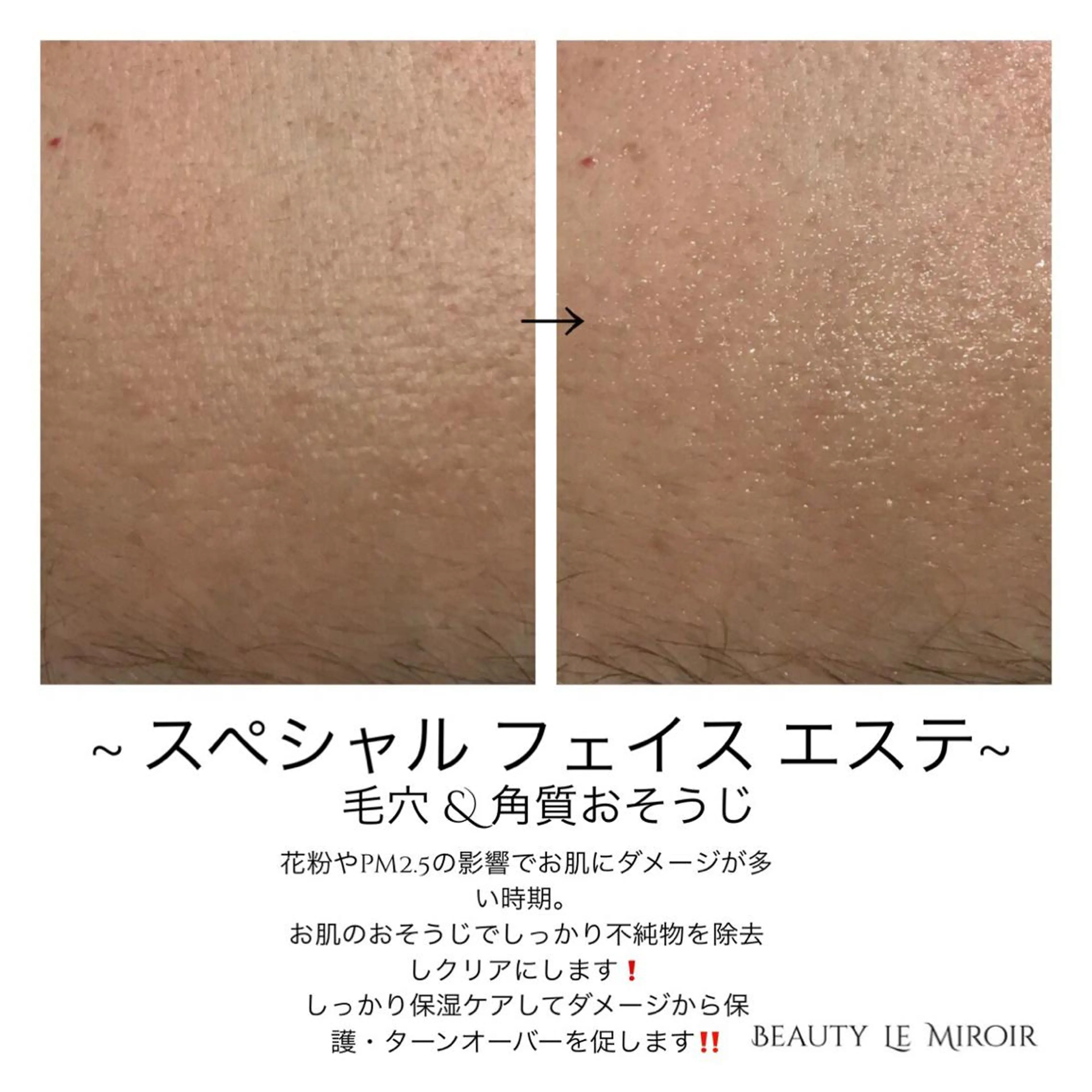 ビューティー ミロワールのエステ・リラクイメージ