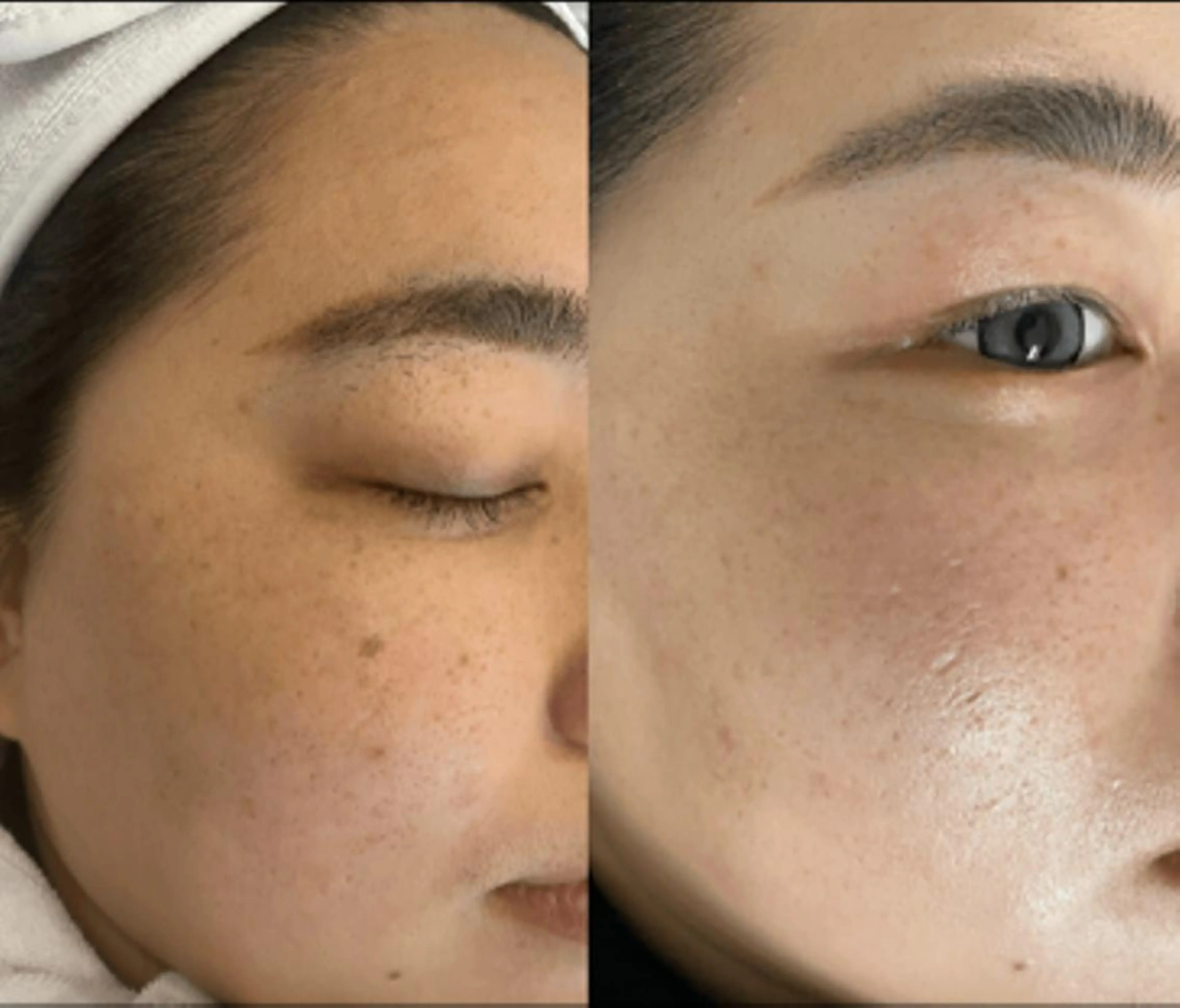 全身脱毛×マッサージ 高岳×新栄×代官町の眉毛・アイブロウイメージ