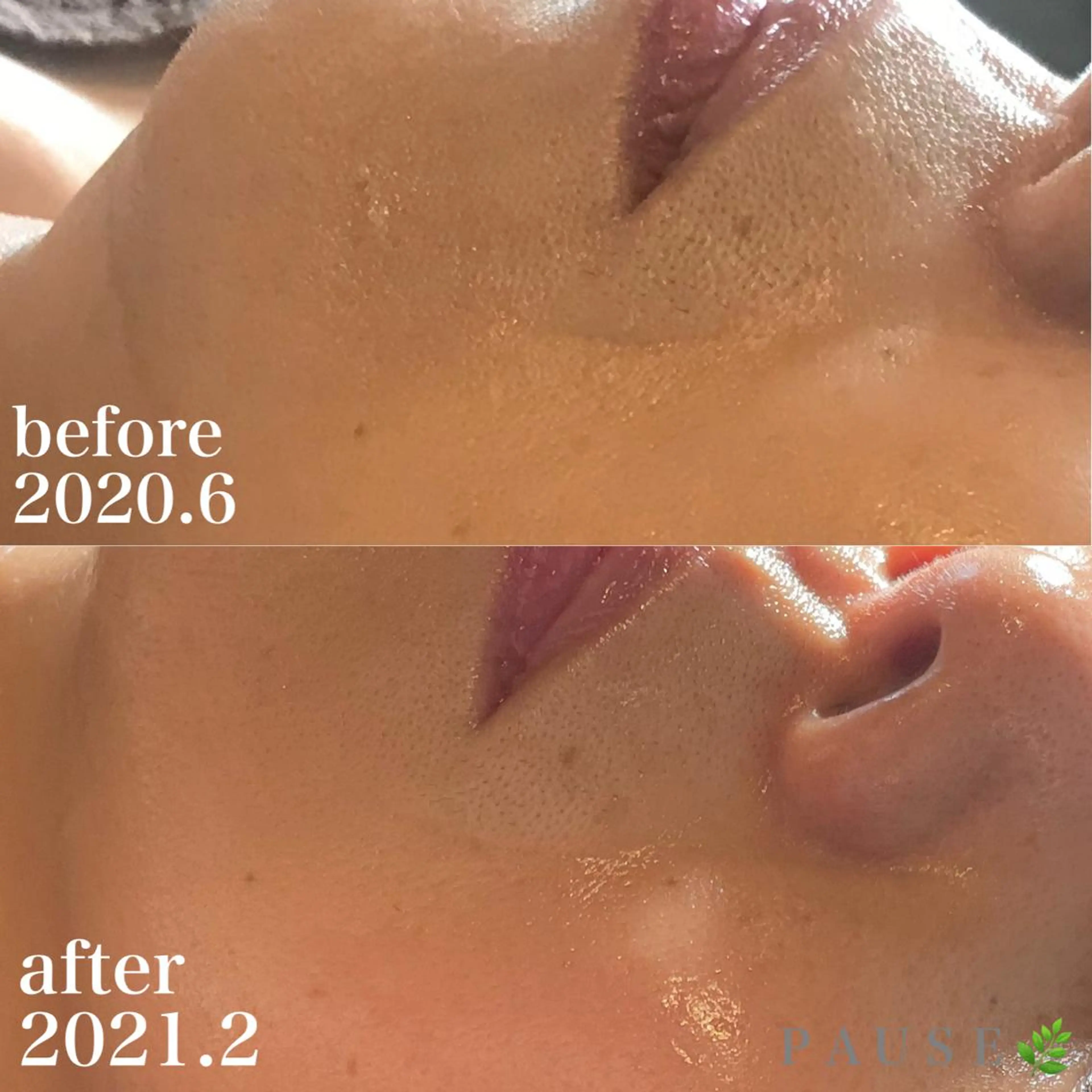 エステ 浜野 恵美のエステ・リラクイメージ