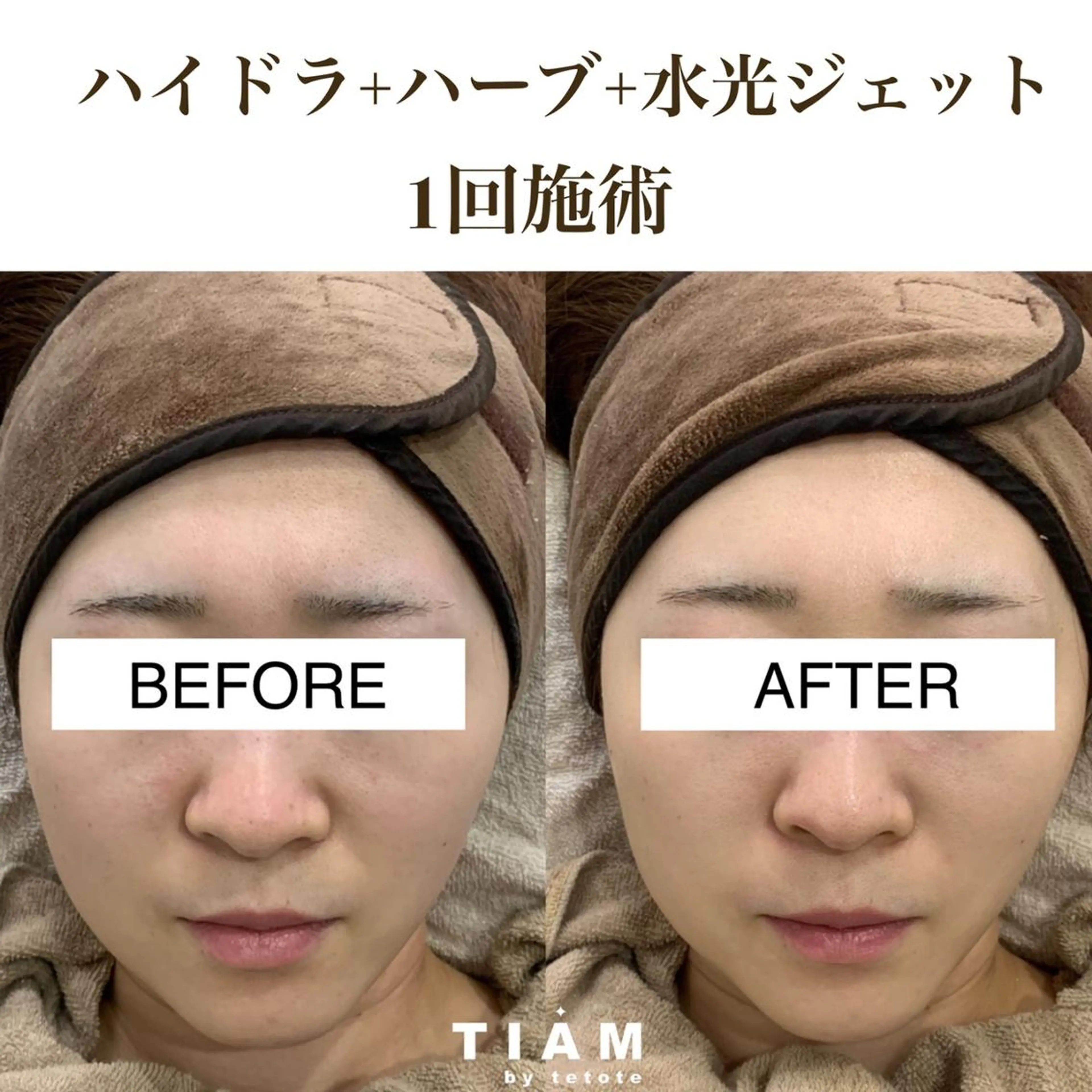 美肌サロンTIAM by tetoteのエステ・リラクイメージ