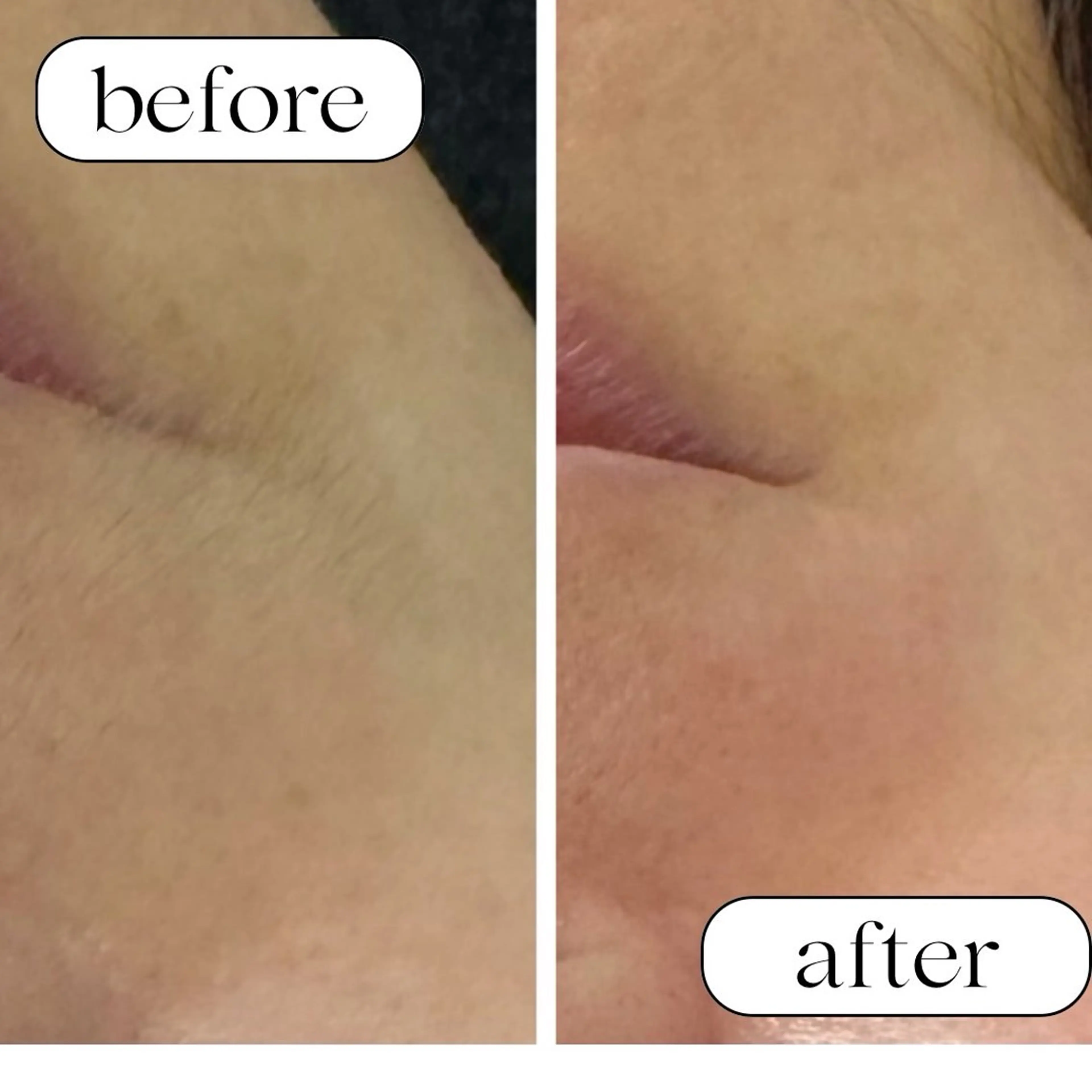 chou. chouのエステ・リラクイメージ