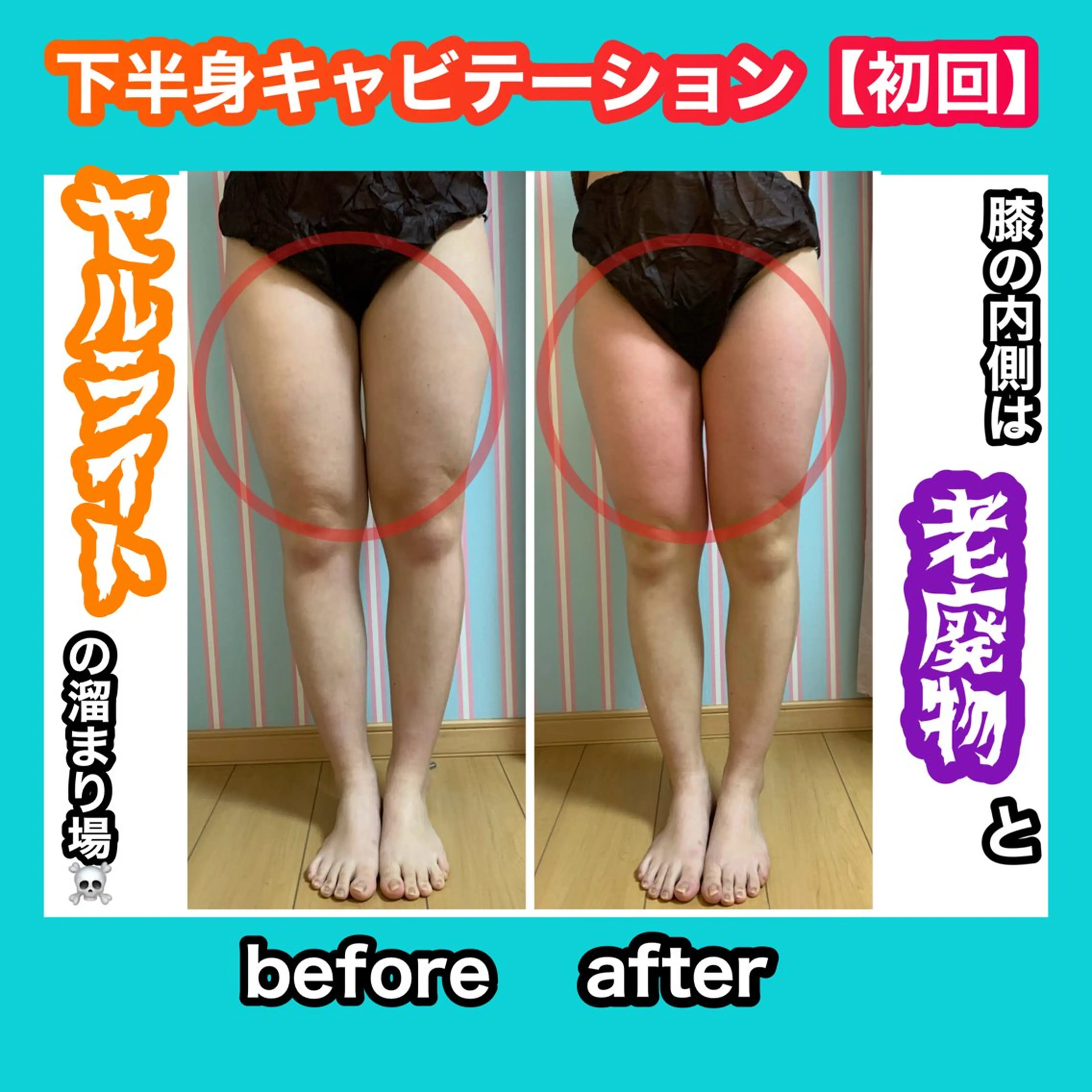 エステ リラク 痩身/脱毛/ネイル HARUKAのエステ・リラクイメージ