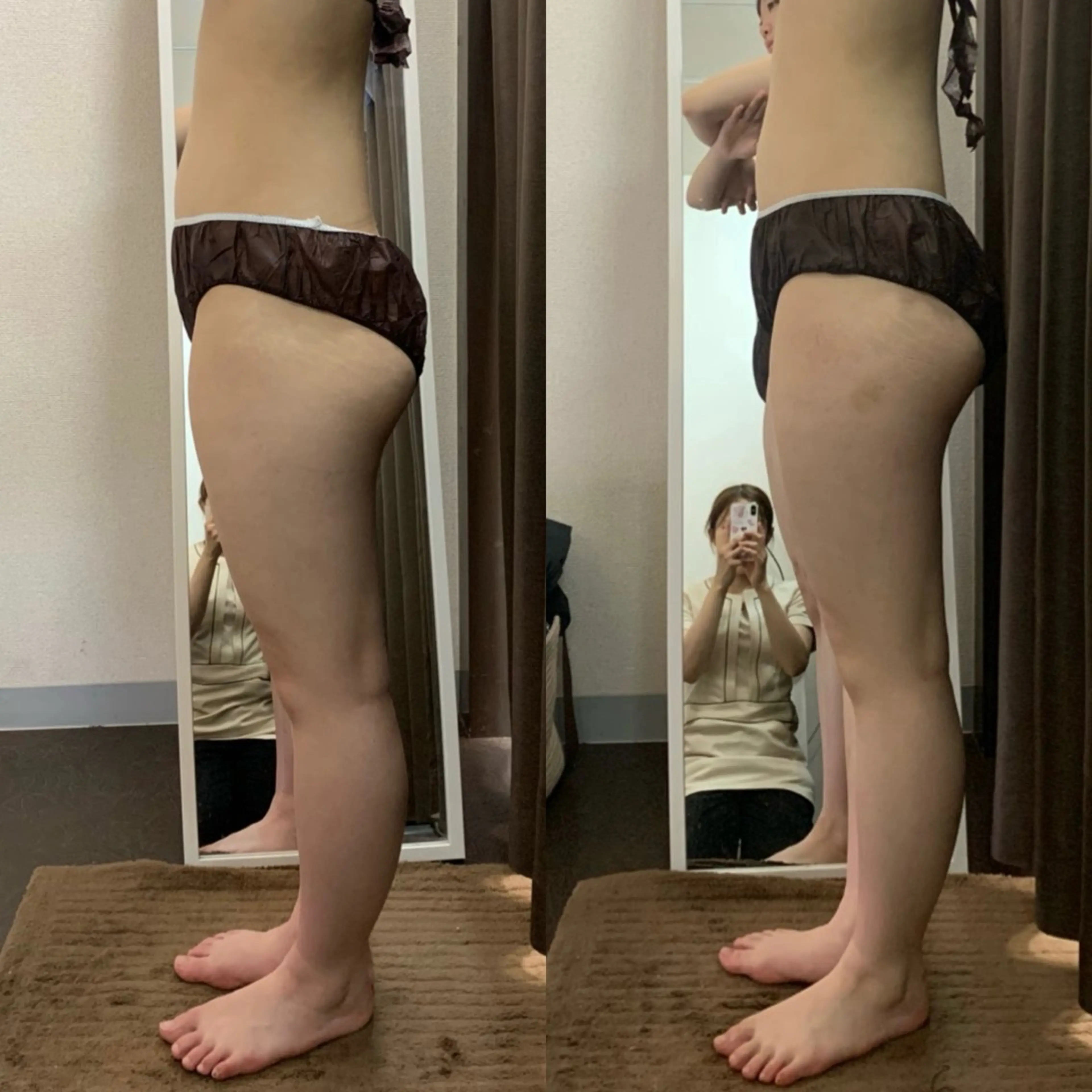 エステ ハイパーナイフ専門店　Salon de COCO所属・Salon de COCOのエステ・リラクイメージ