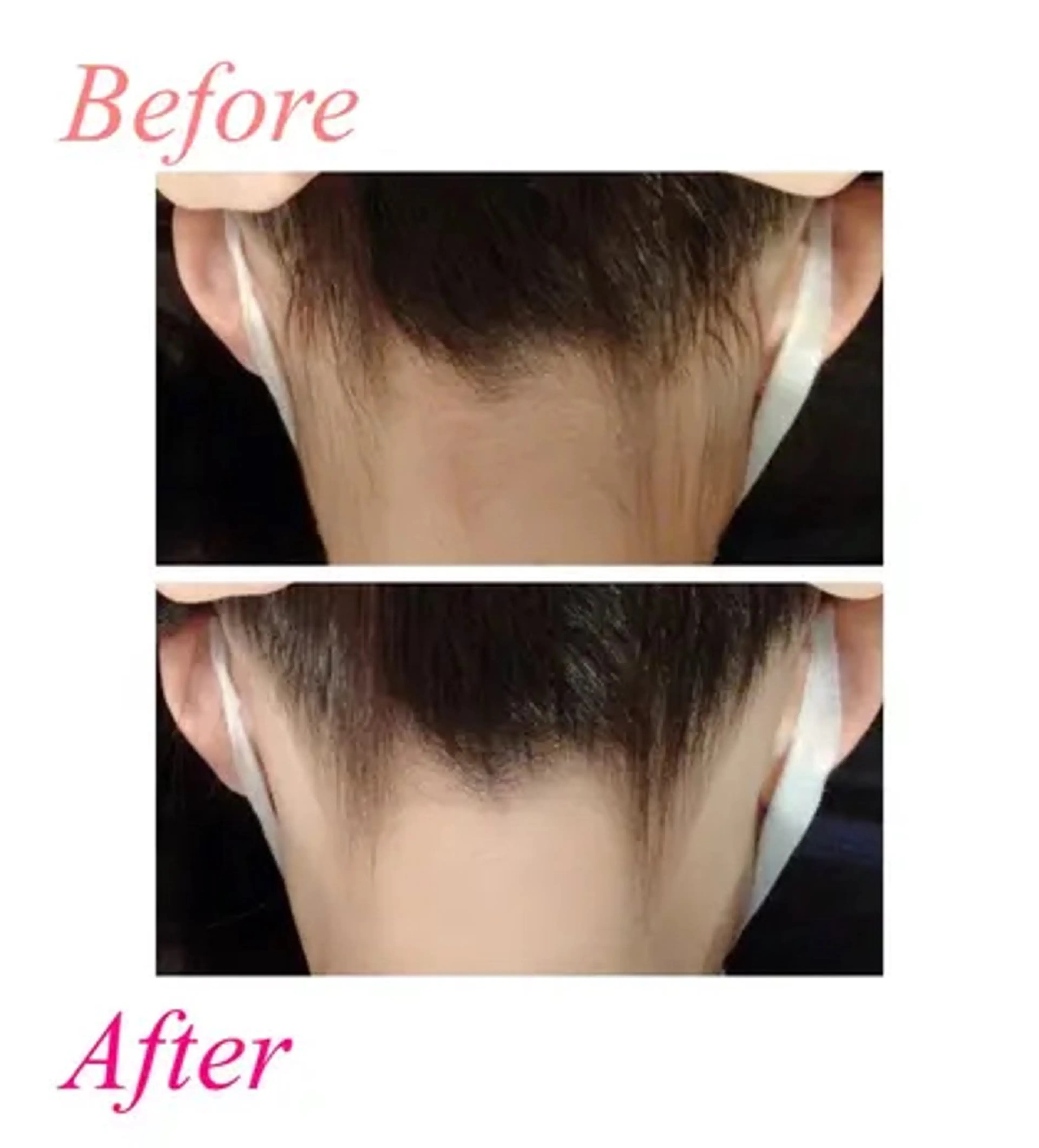 トータルサロンRuby所属・【医療提携】小顔 整体ハーブピーリングのエステ・リラクイメージ