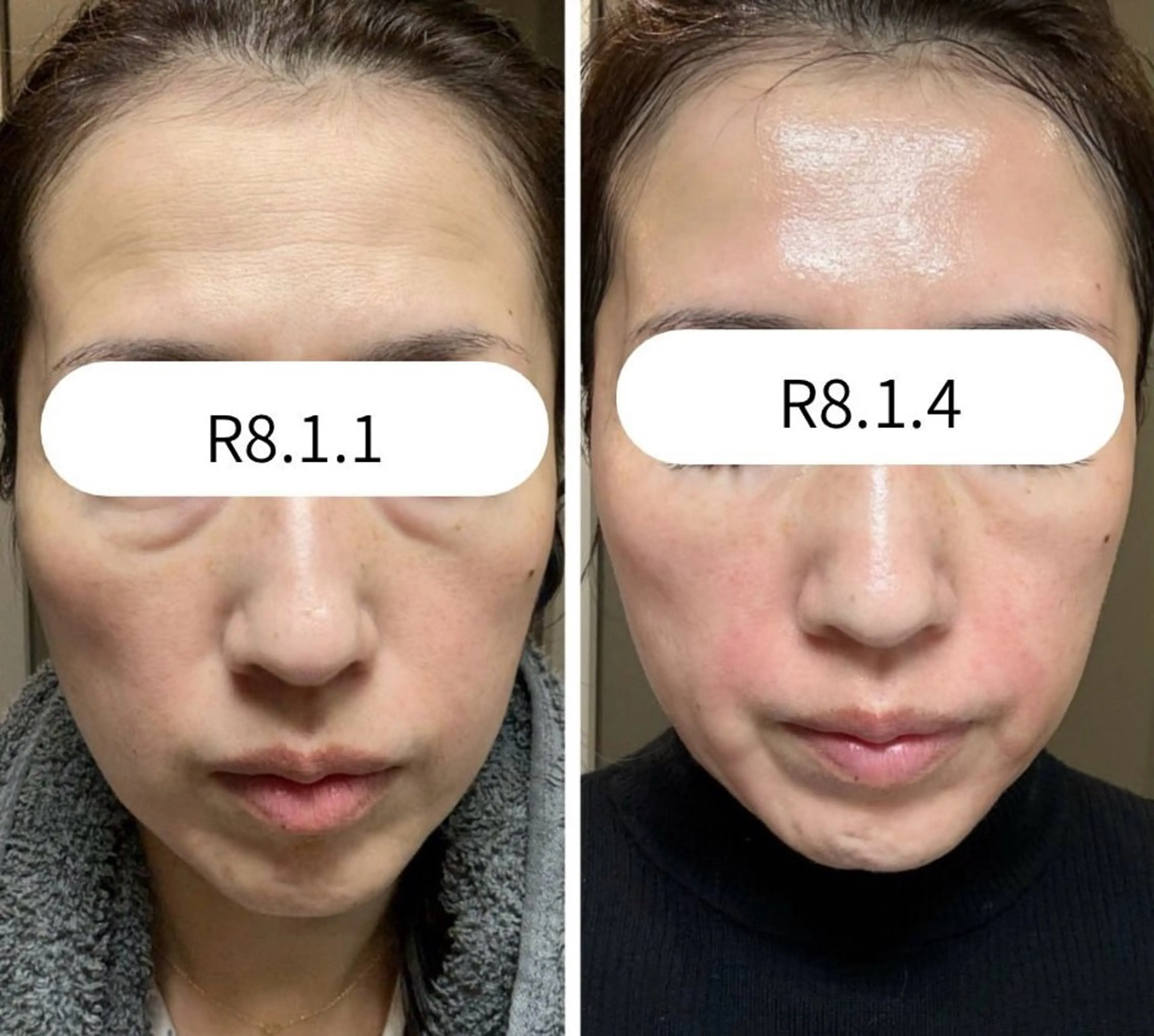 エステ 小顔/たるみ/黒ずみ除去専門サロン/SONA 大和西大寺店所属・【小顔専門看護師 サロンSONA】のエステ・リラクイメージ