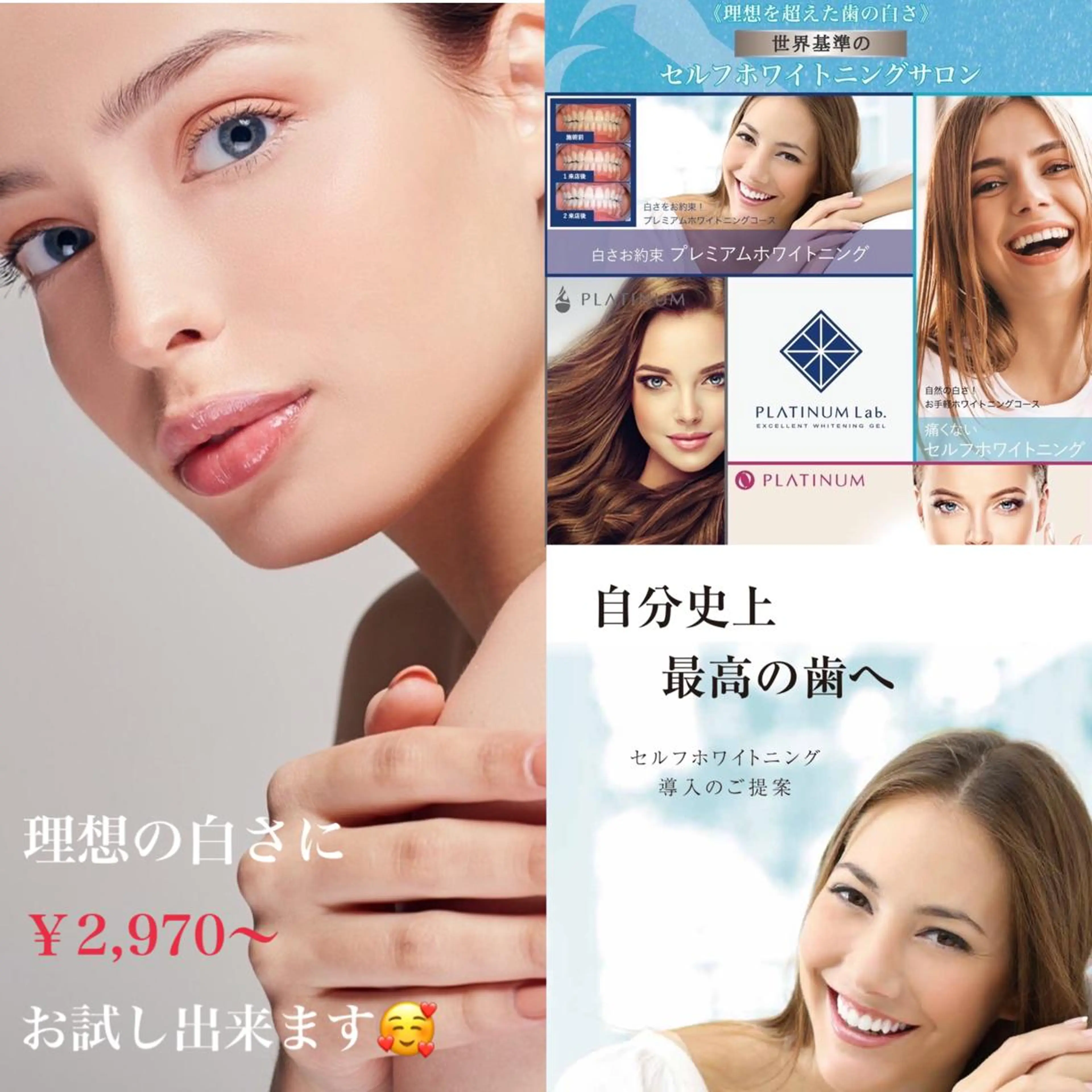 ☆専門店にお任せ☆ ホワイトニング吉祥寺のその他イメージ