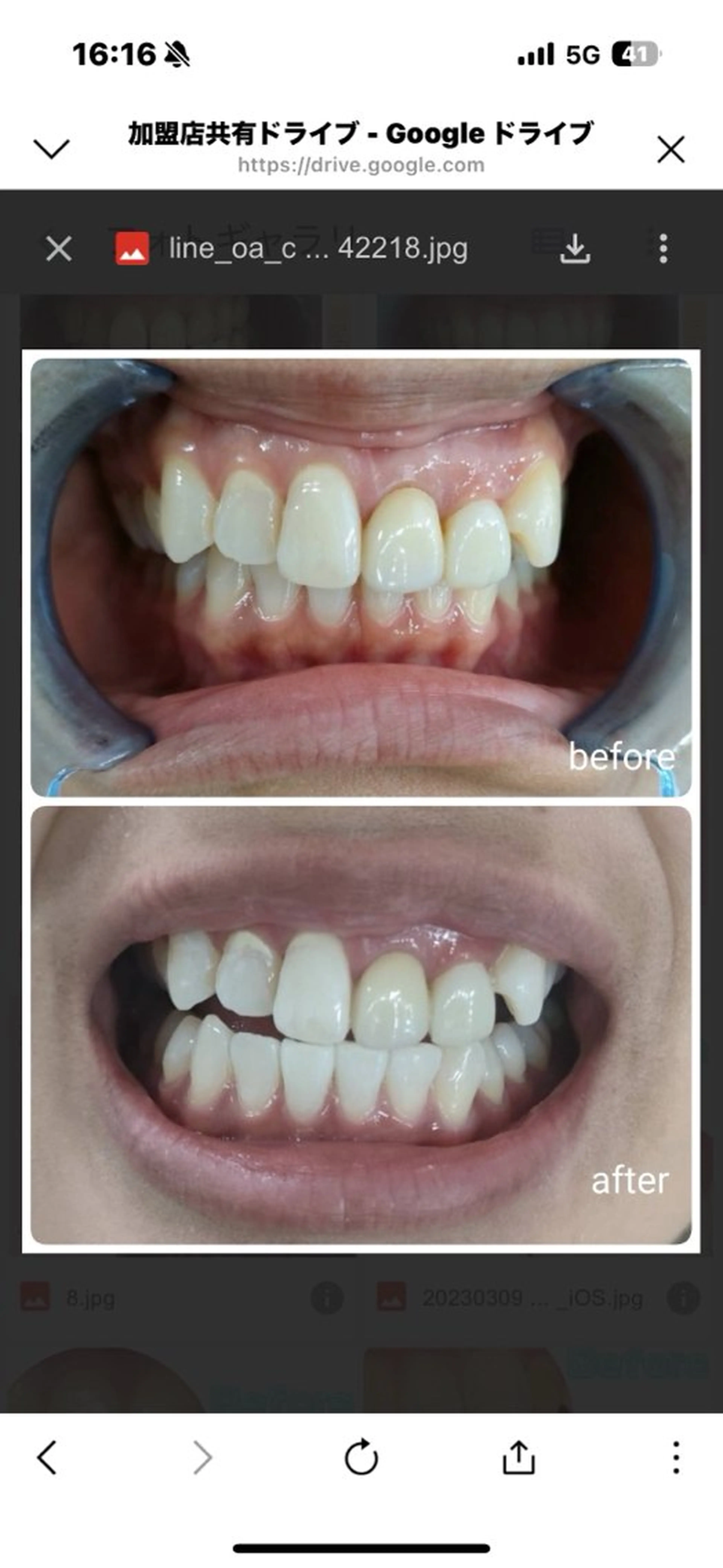 エクシアホワイト長野店所属・セルフホワイトニング エクシア長野店のその他イメージ