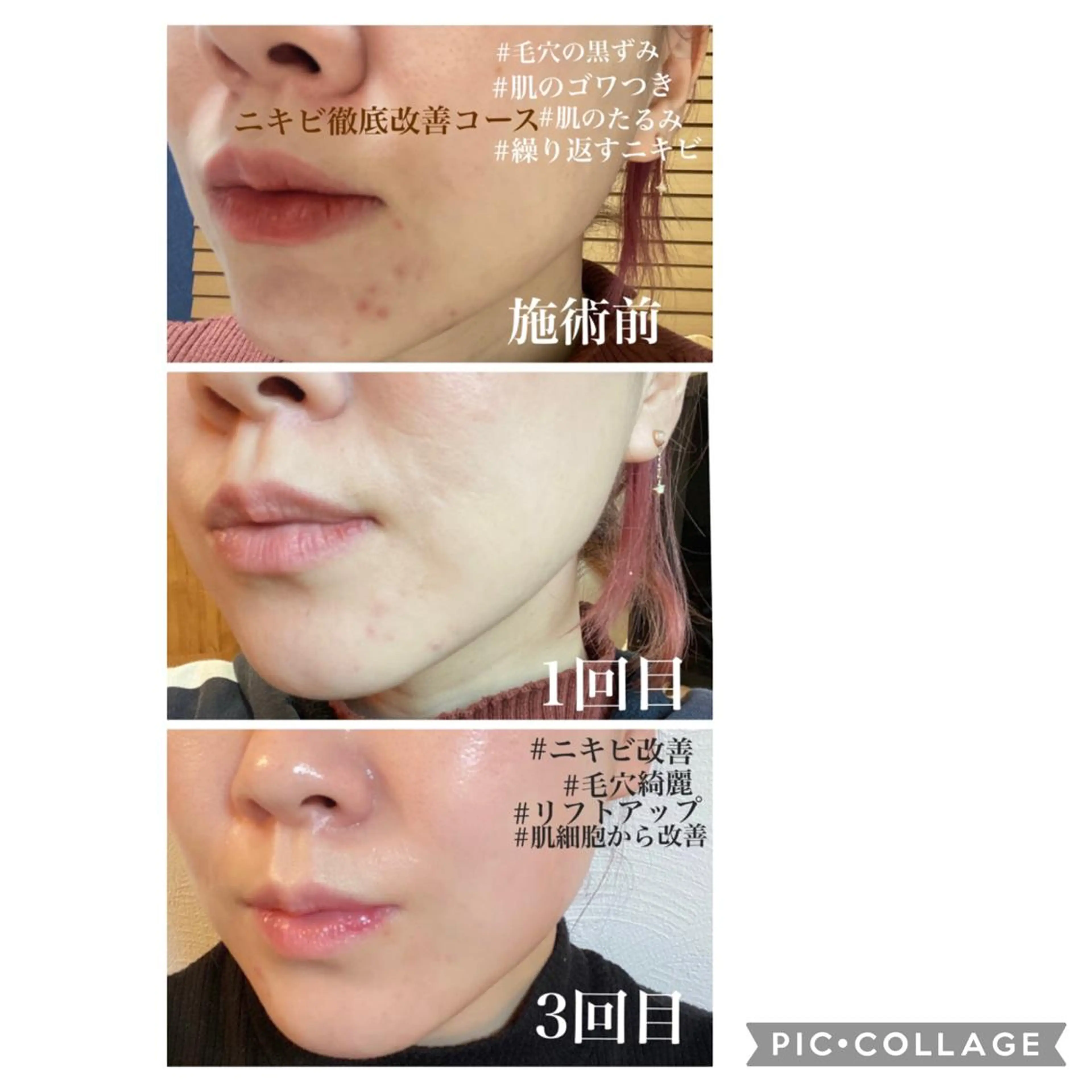 エステ De I'm トータルビューティーサロン所属・COCO beautyサロンのエステ・リラクイメージ