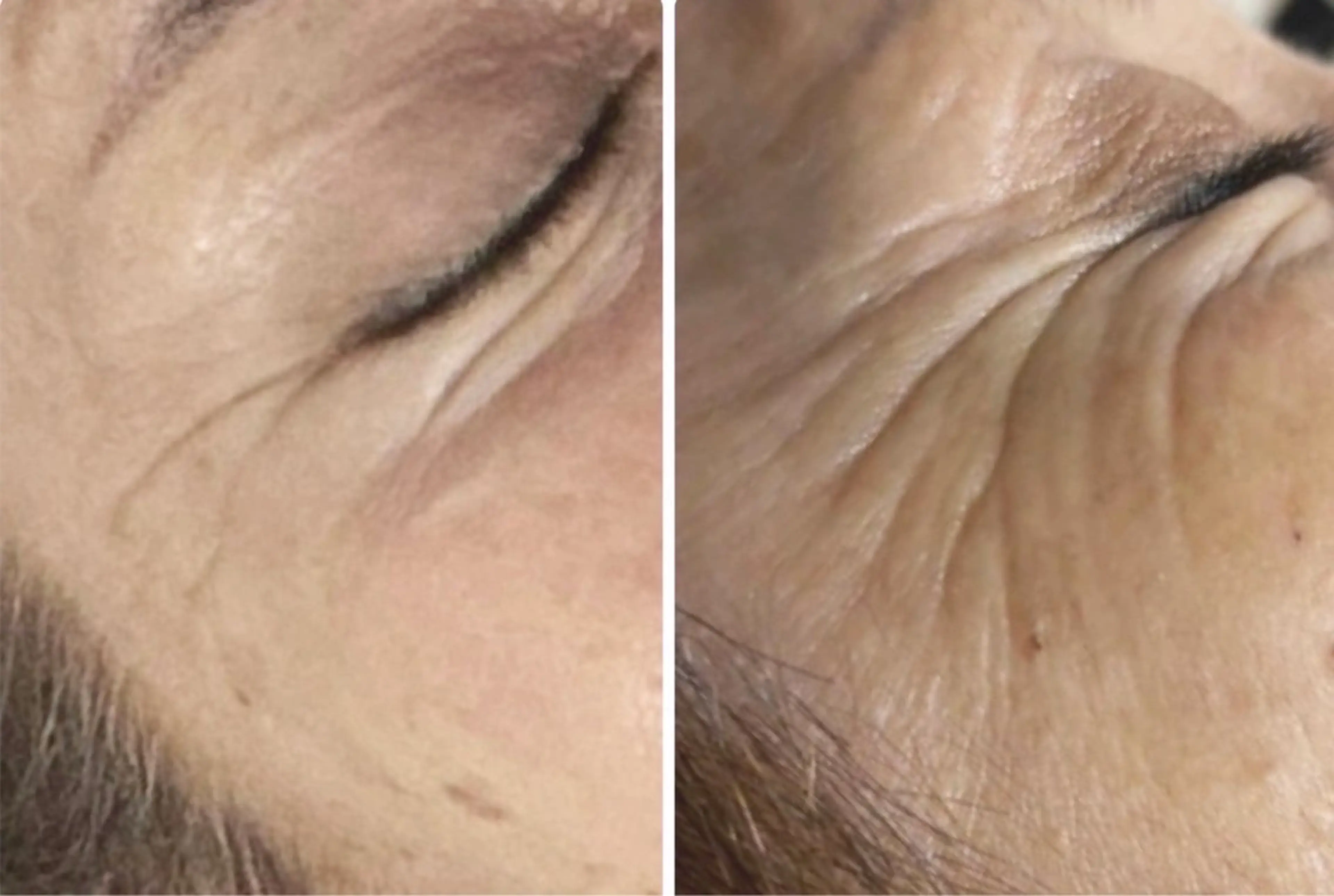 エステ リラク まいまい／八尾／JR 久宝寺／サロンのエステ・リラクイメージ