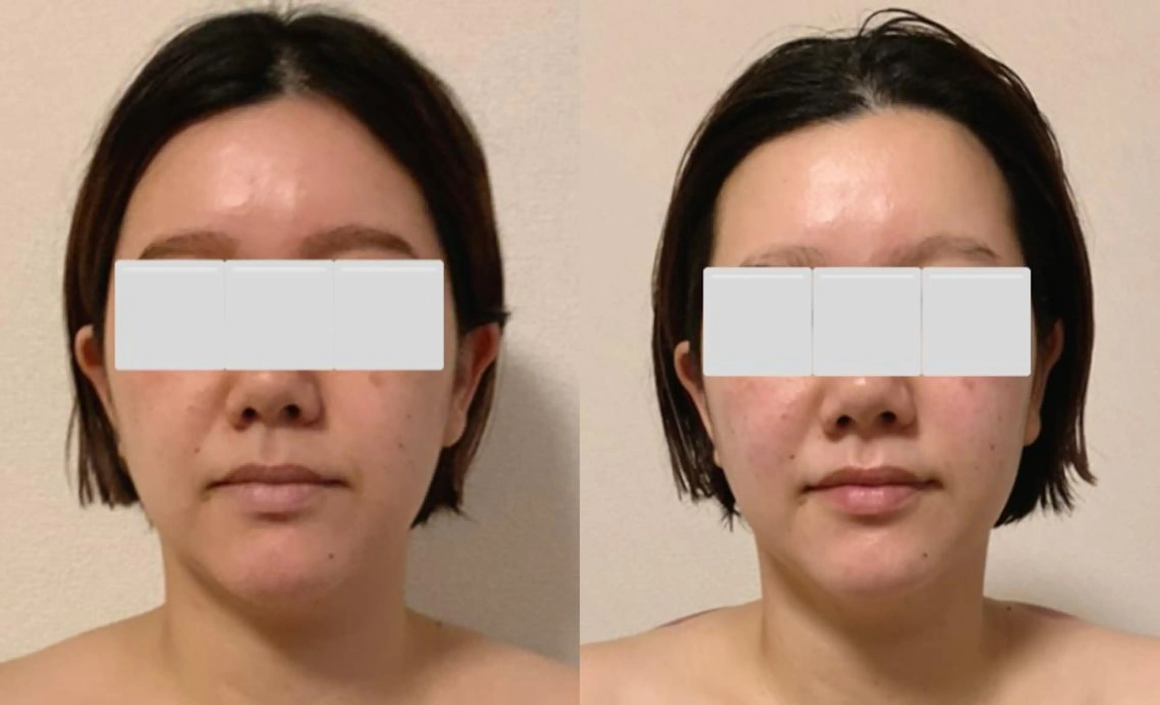 a  room salonのエステ・リラクイメージ