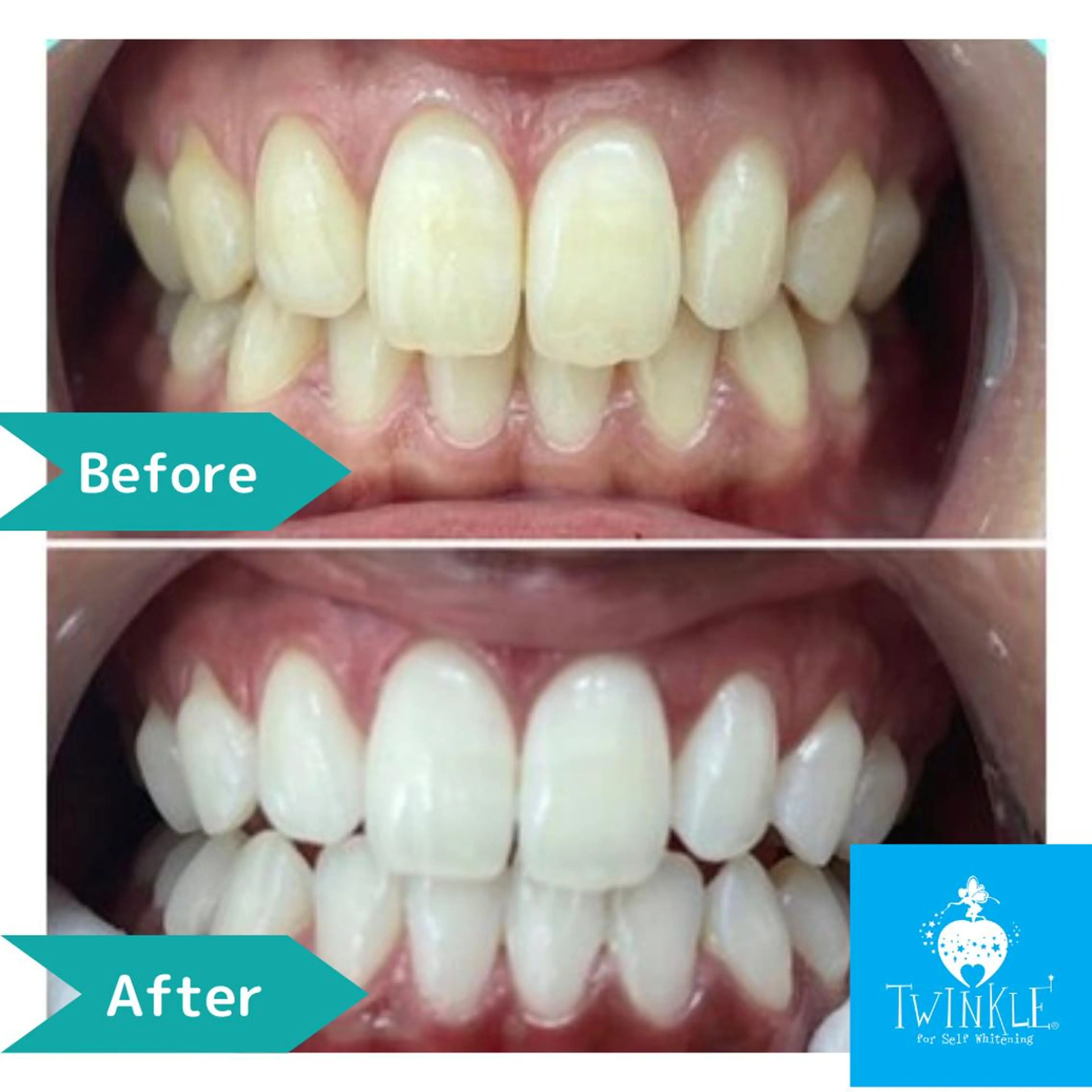 Twinkle White上尾店のエステ・リラクイメージ