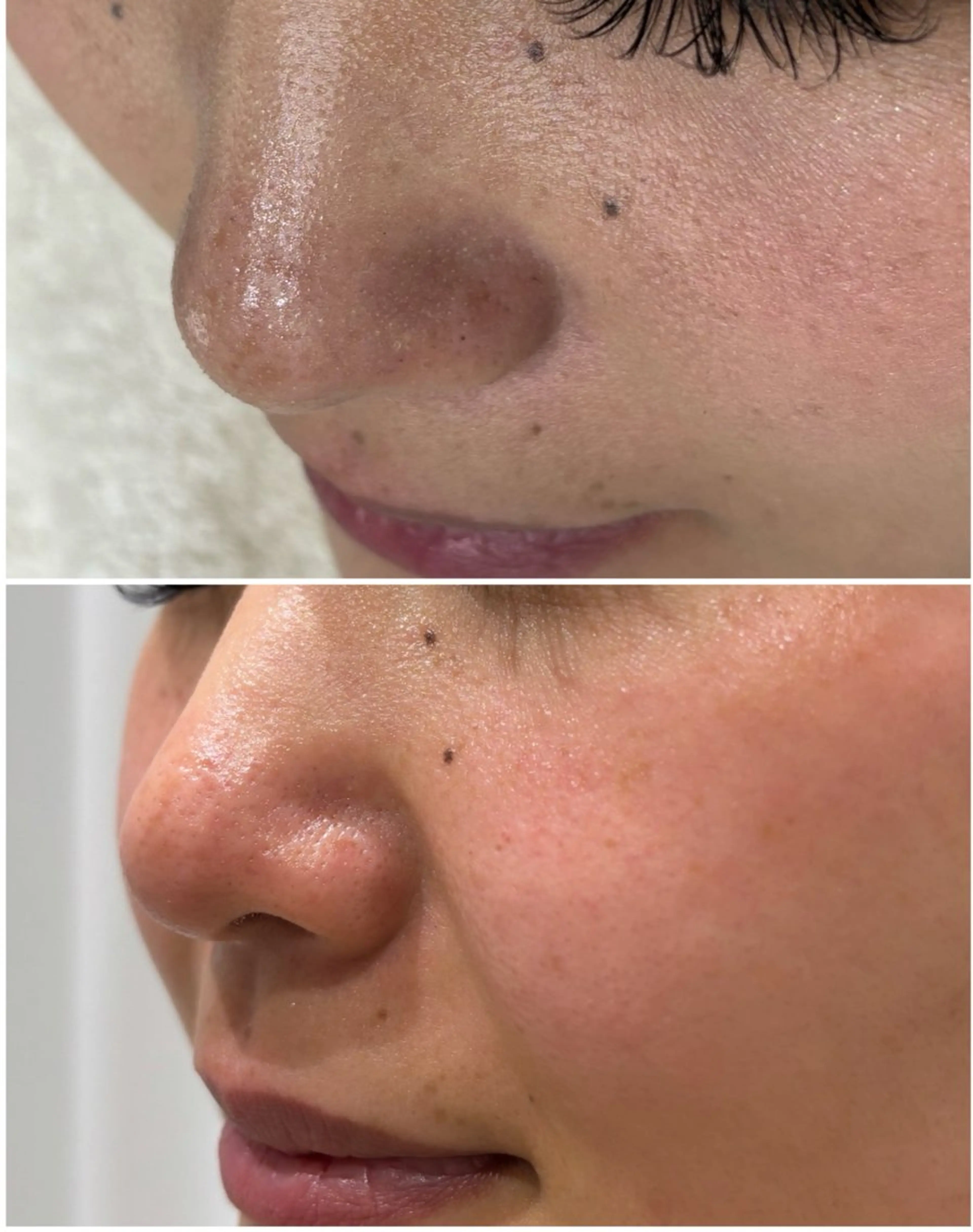 エステ MY FAIR LADY所属・毛穴に特化したサロン MYFAIRLADYのエステ・リラクイメージ