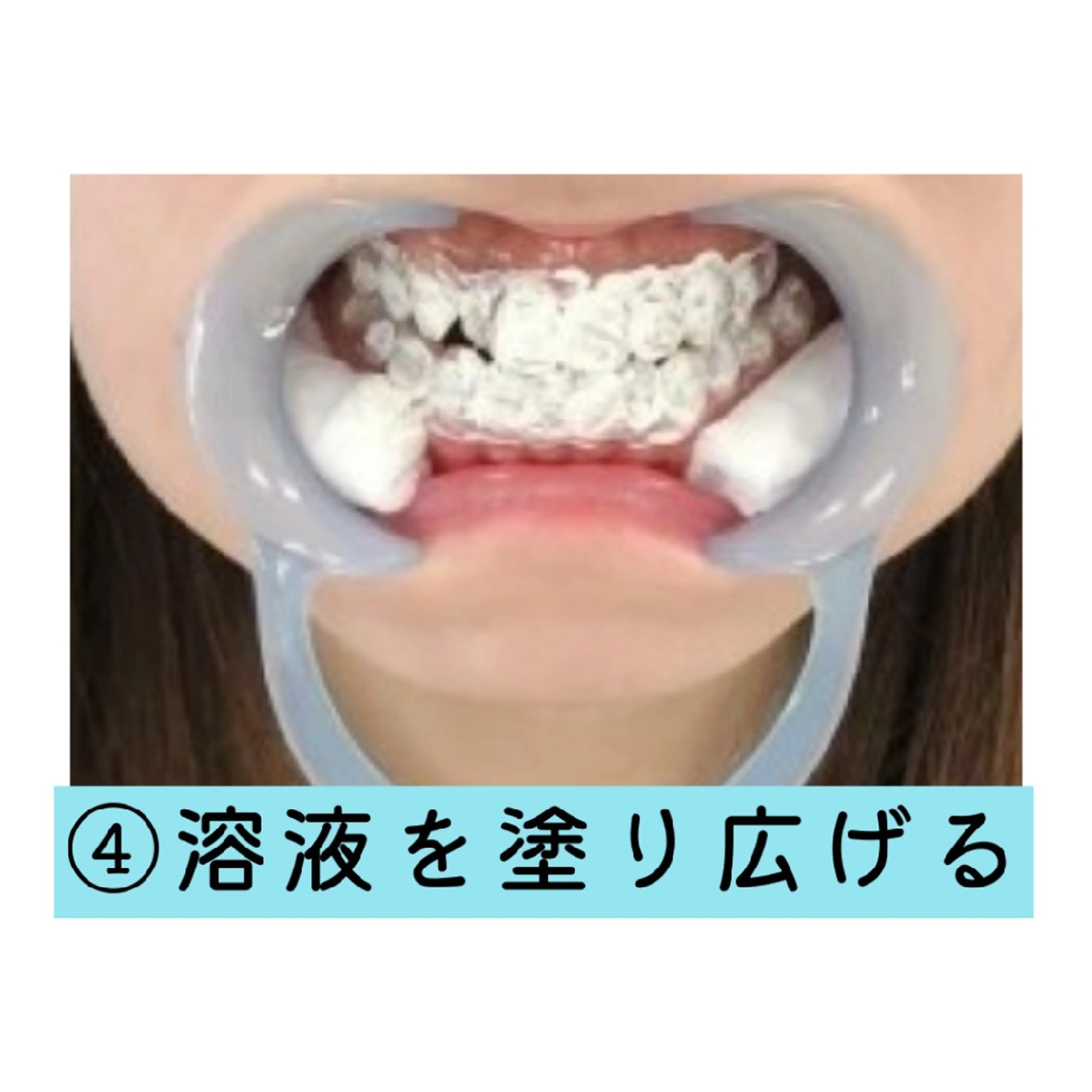 ホワイトニングサロン ネージュ(女性専用)のその他イメージ