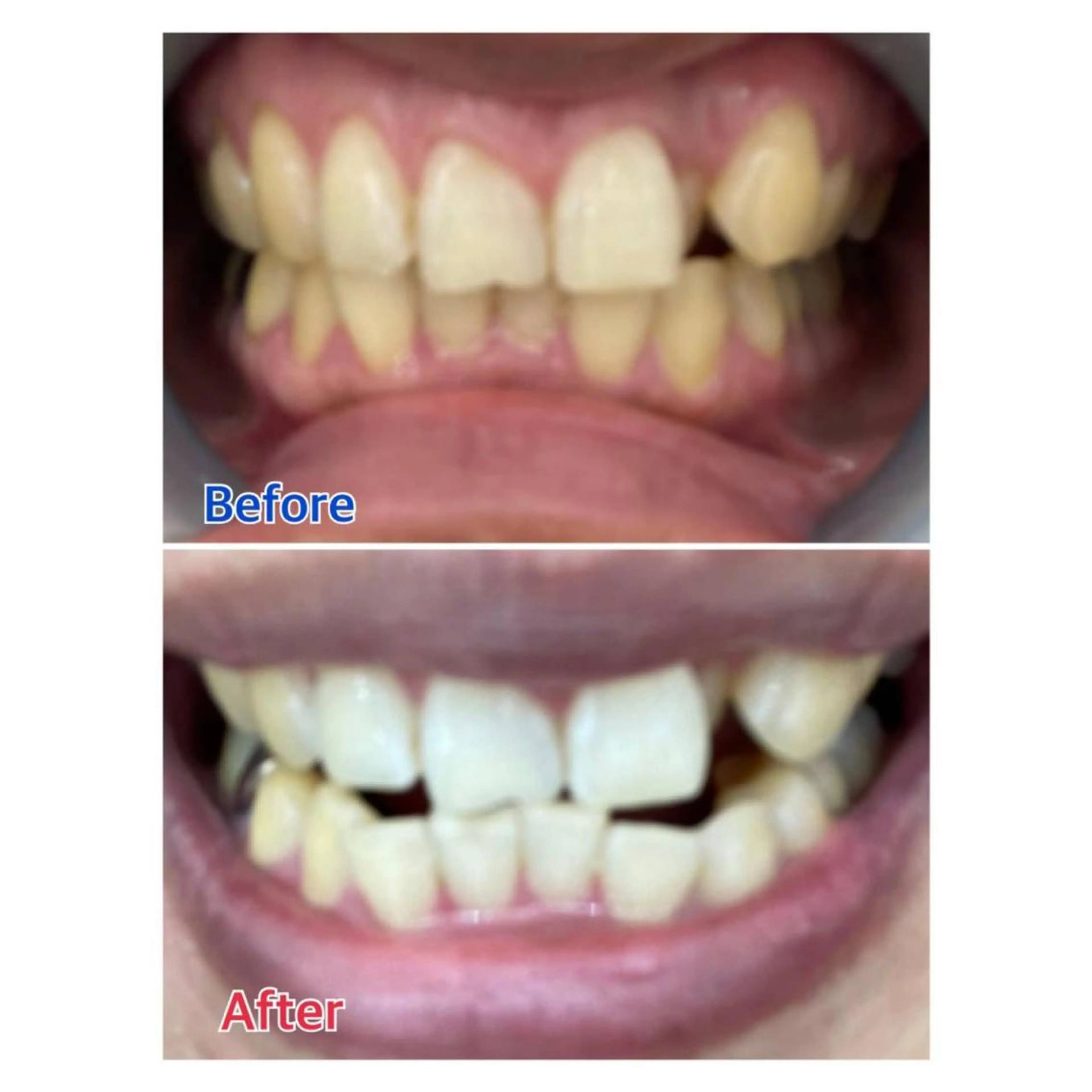 MBEAUTYSALON 千葉店・京成大久保所属・Melty 輝のその他イメージ