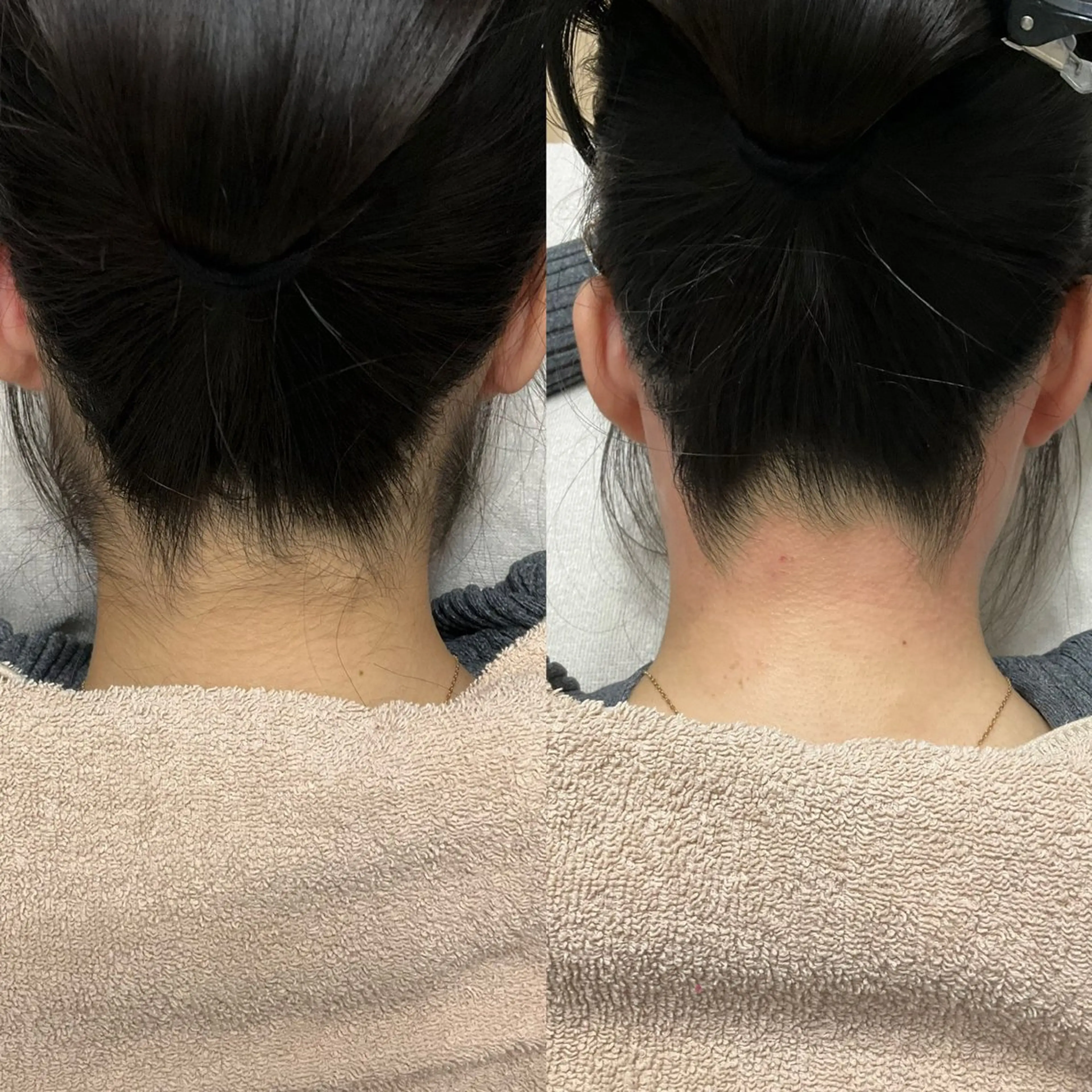 Bloom 池袋西口店〔ブルーム〕所属・池袋SATOMI🫧 完全度払い脱毛のエステ・リラクイメージ