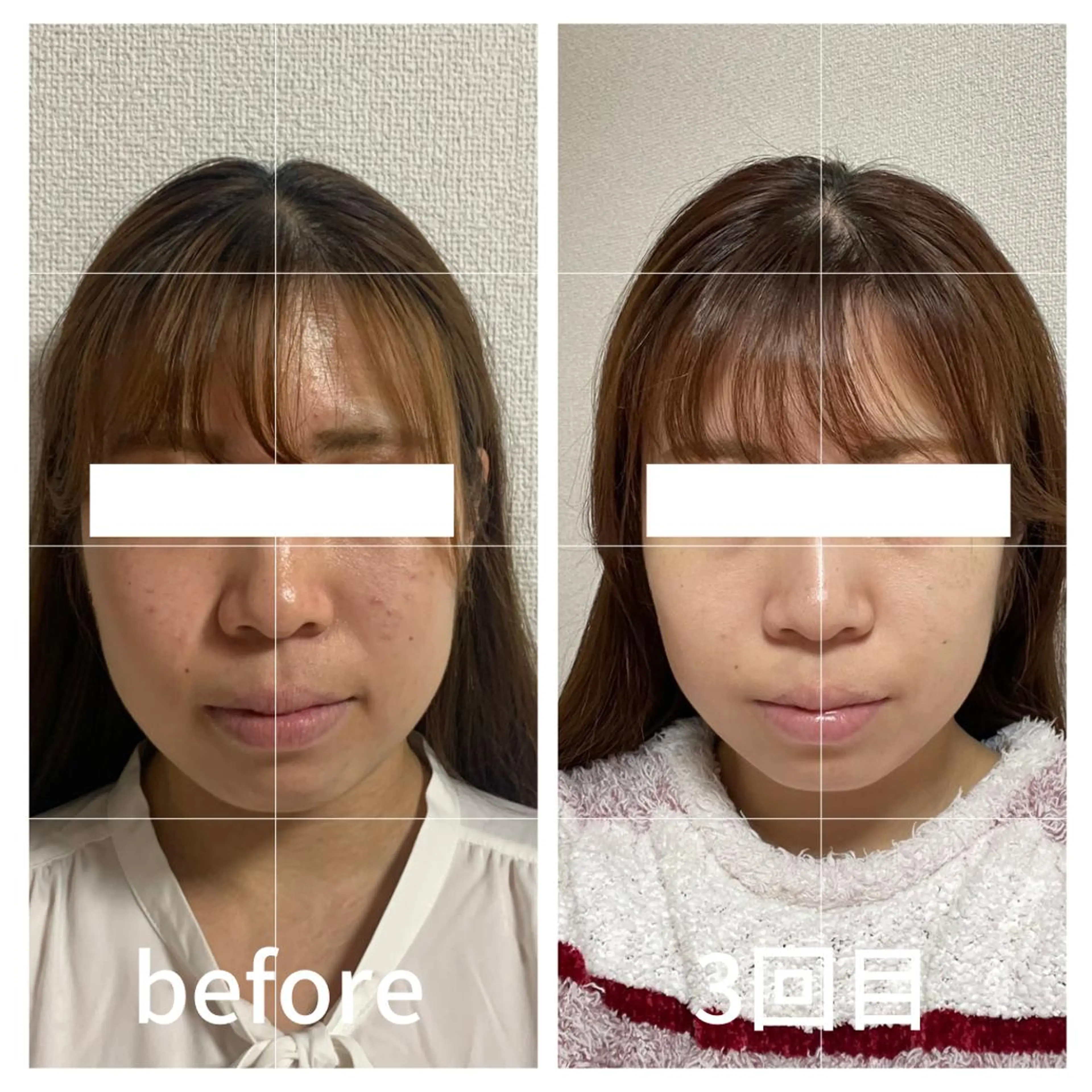 小顔サロン AMYONのエステ・リラクイメージ