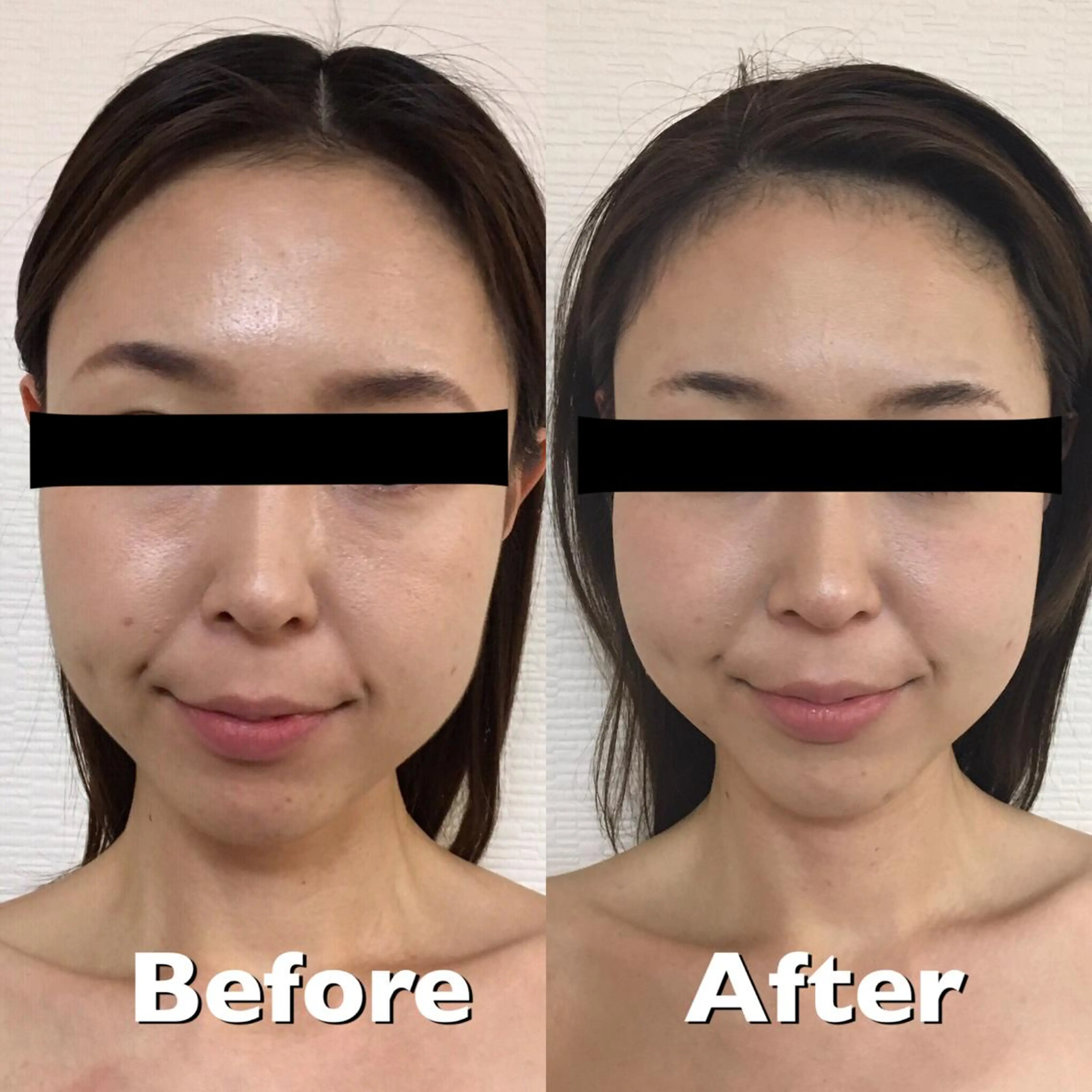 桜Biscuit所属・小顔筋膜矯正サロン 桜Biscuitのエステ・リラクイメージ