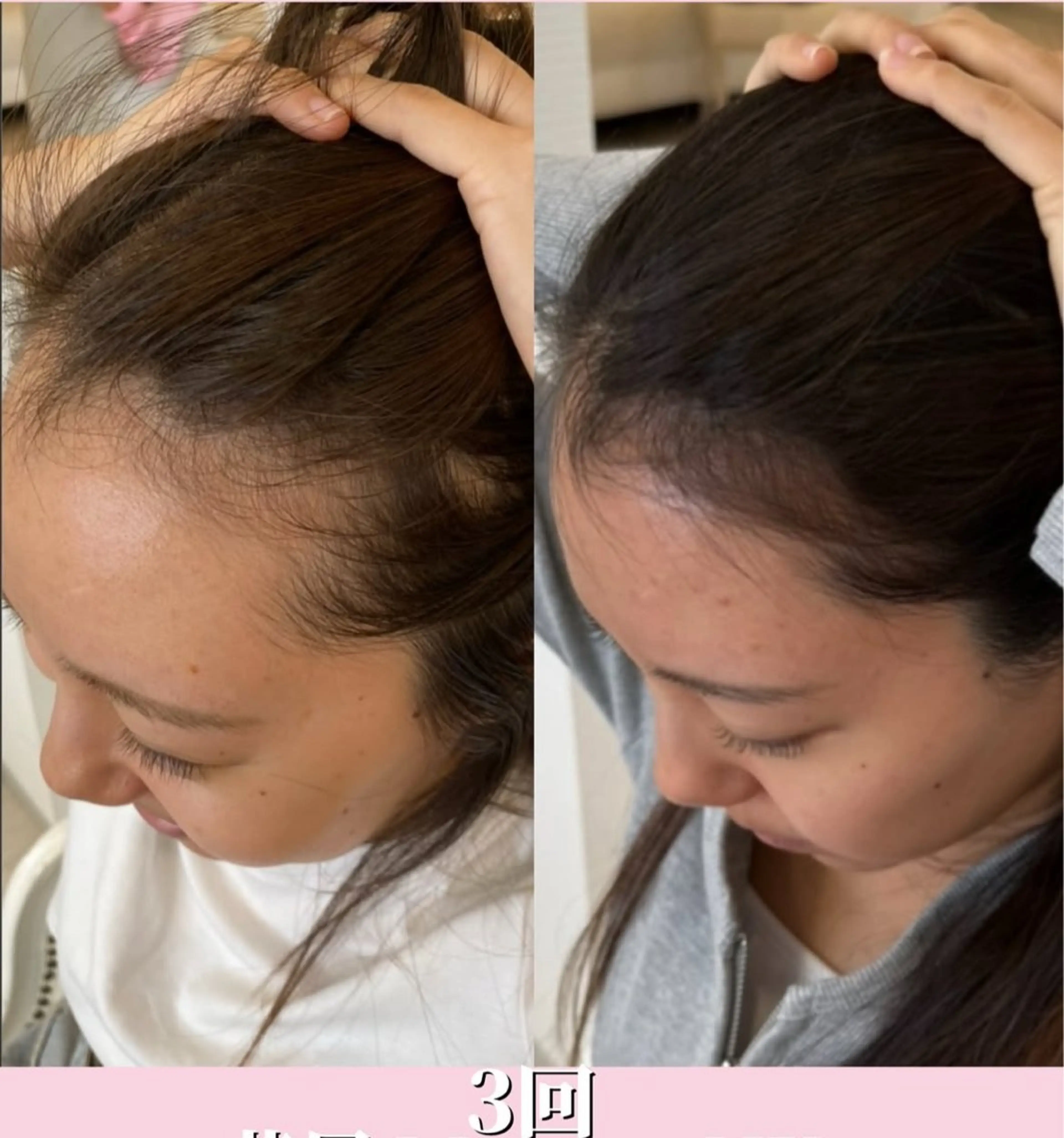 Blooming所属・LOUISE. ／肌質・頭皮のエステ・リラクイメージ