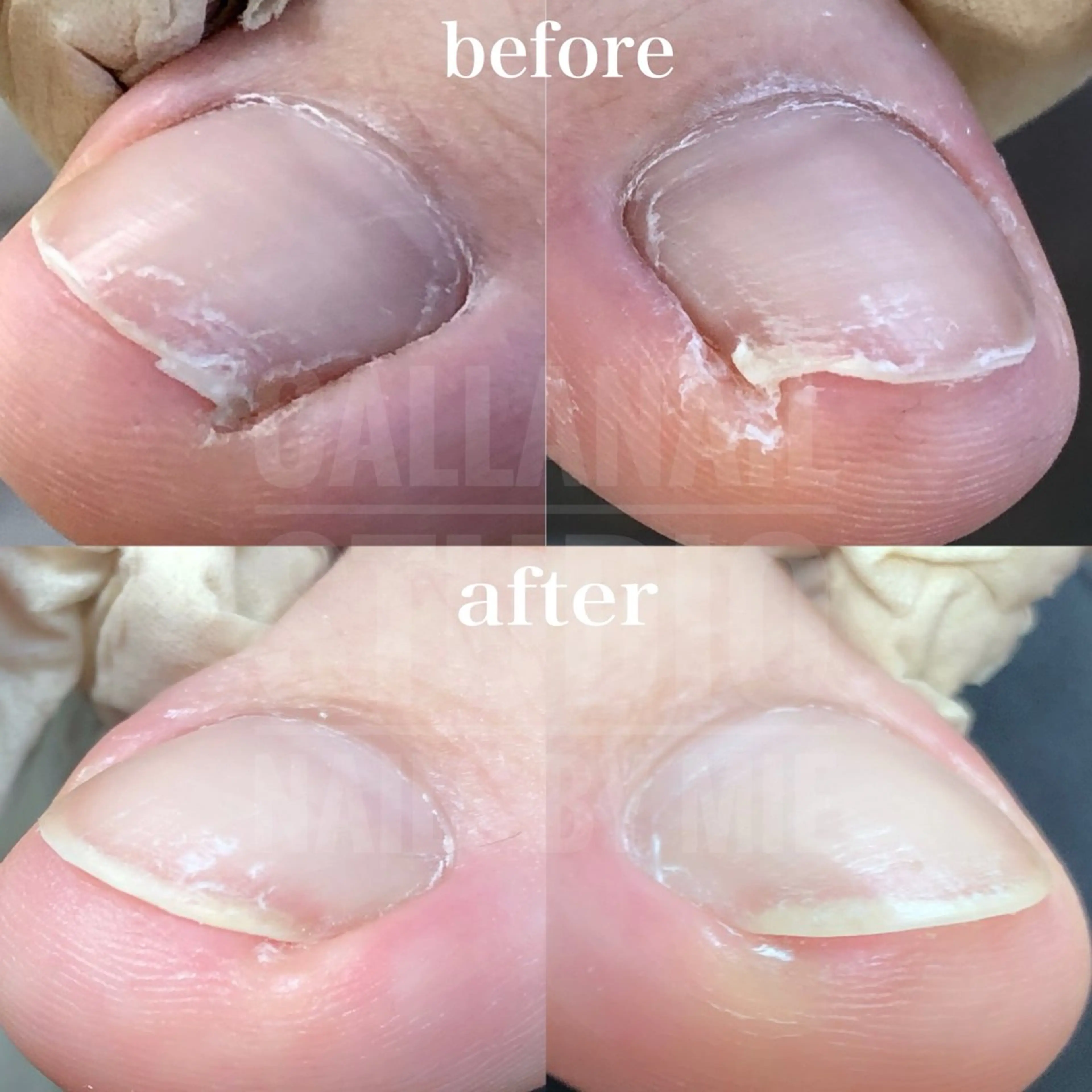 ネイル その他(ネイル) mie ミイのネイルデザイン