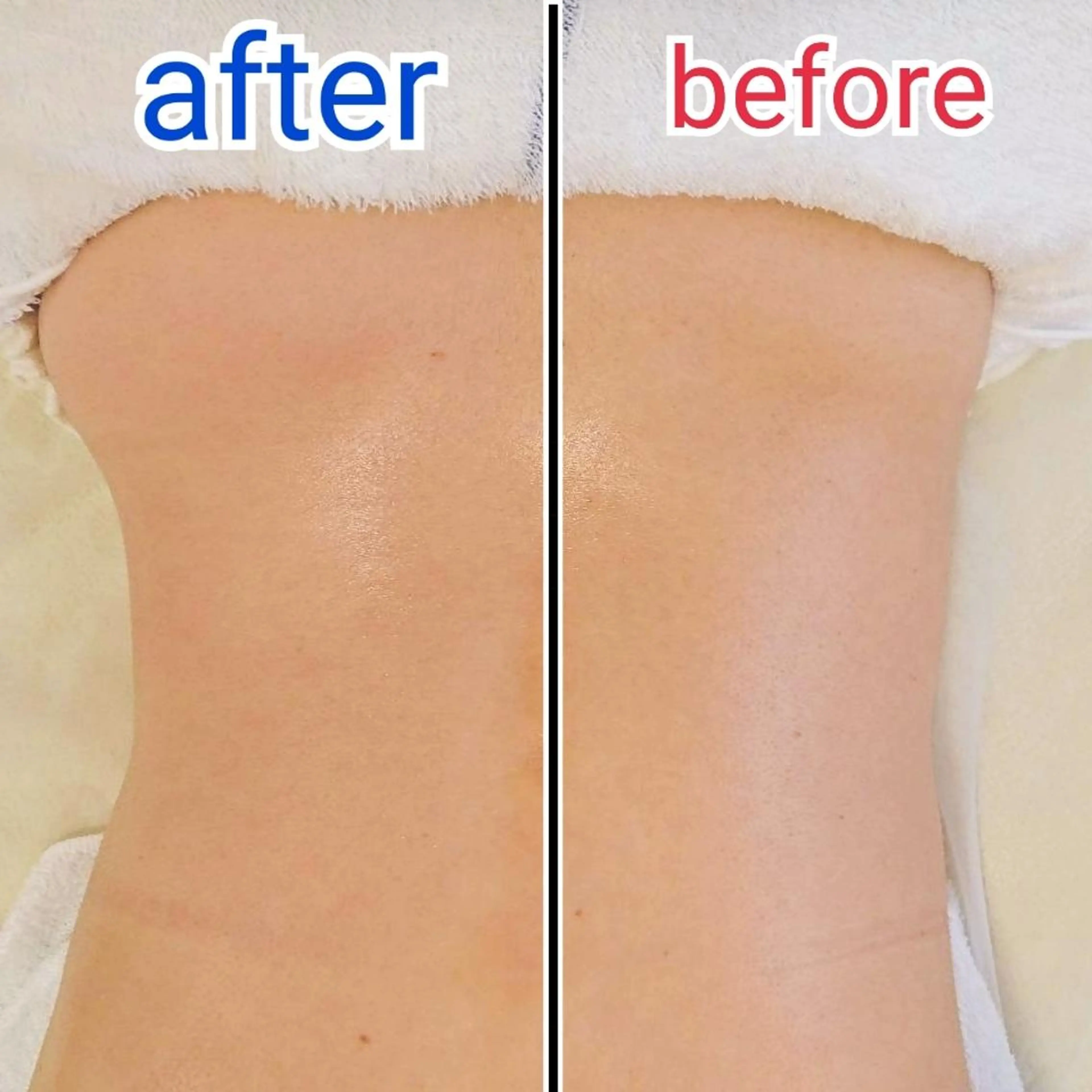 ミニモ限定✴️バック&アームコース✴️💓ボディケア品詰め合わせ🉐プレゼント付き🎁の写真