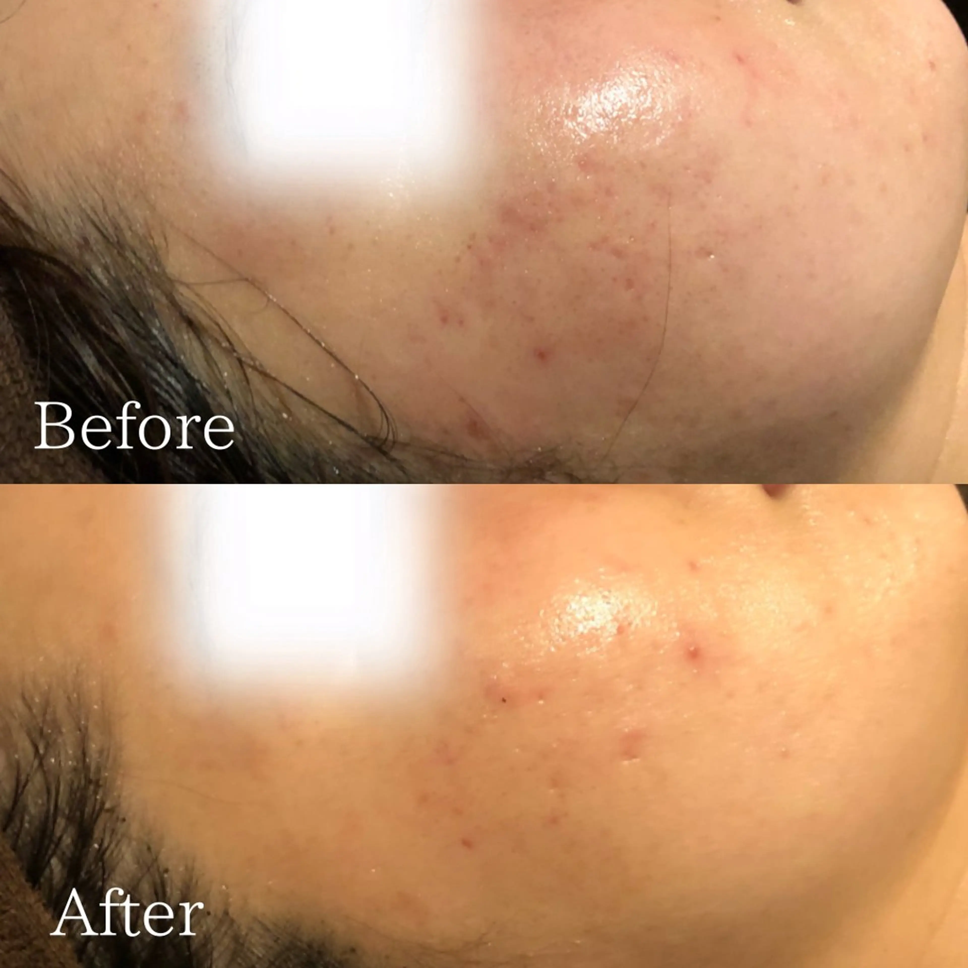 エステ 痩身専門サロン ビューティーグランツのエステ・リラクイメージ