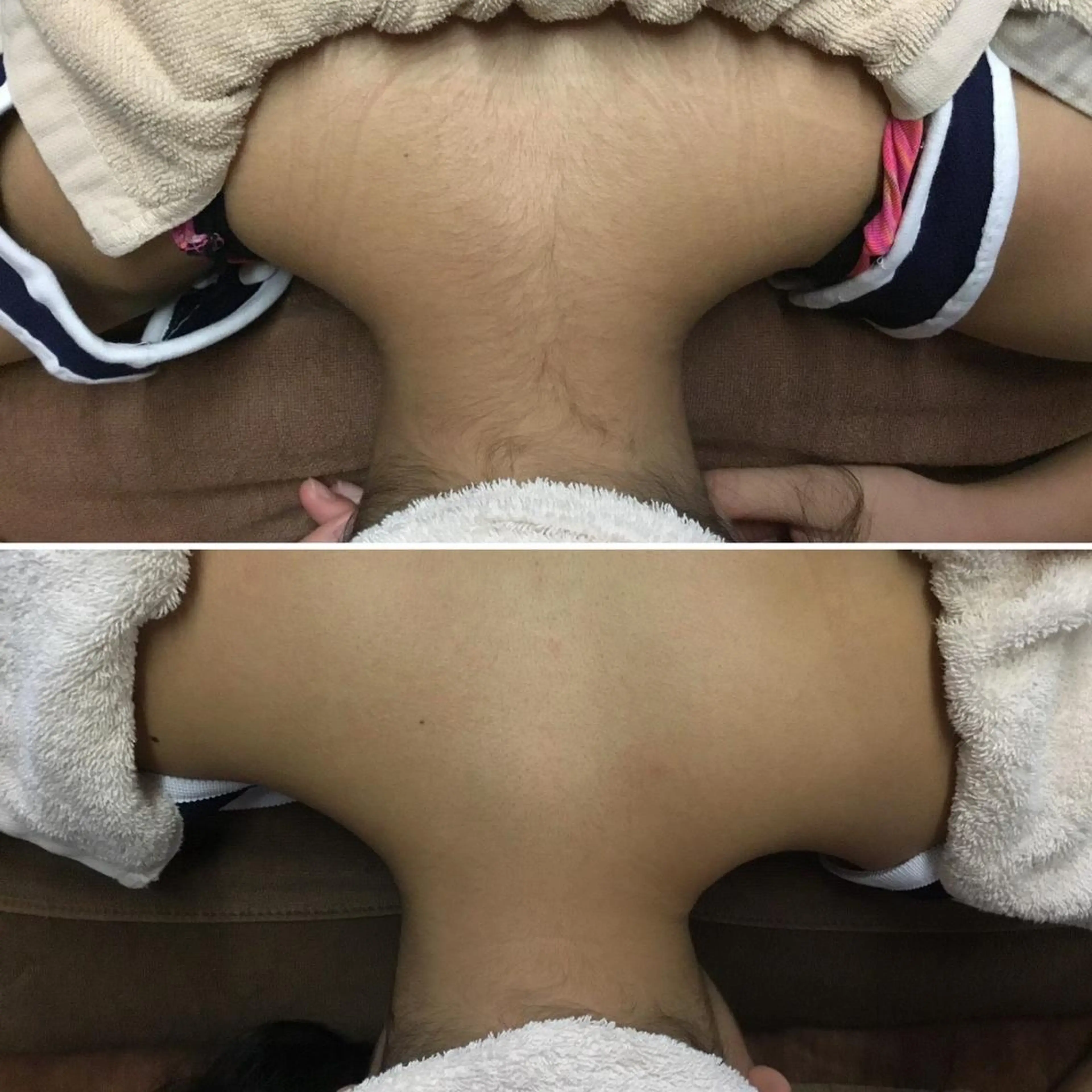 キッズ 脱毛 ULULU上野店所属・ULULU 上野店のエステ・リラクイメージ