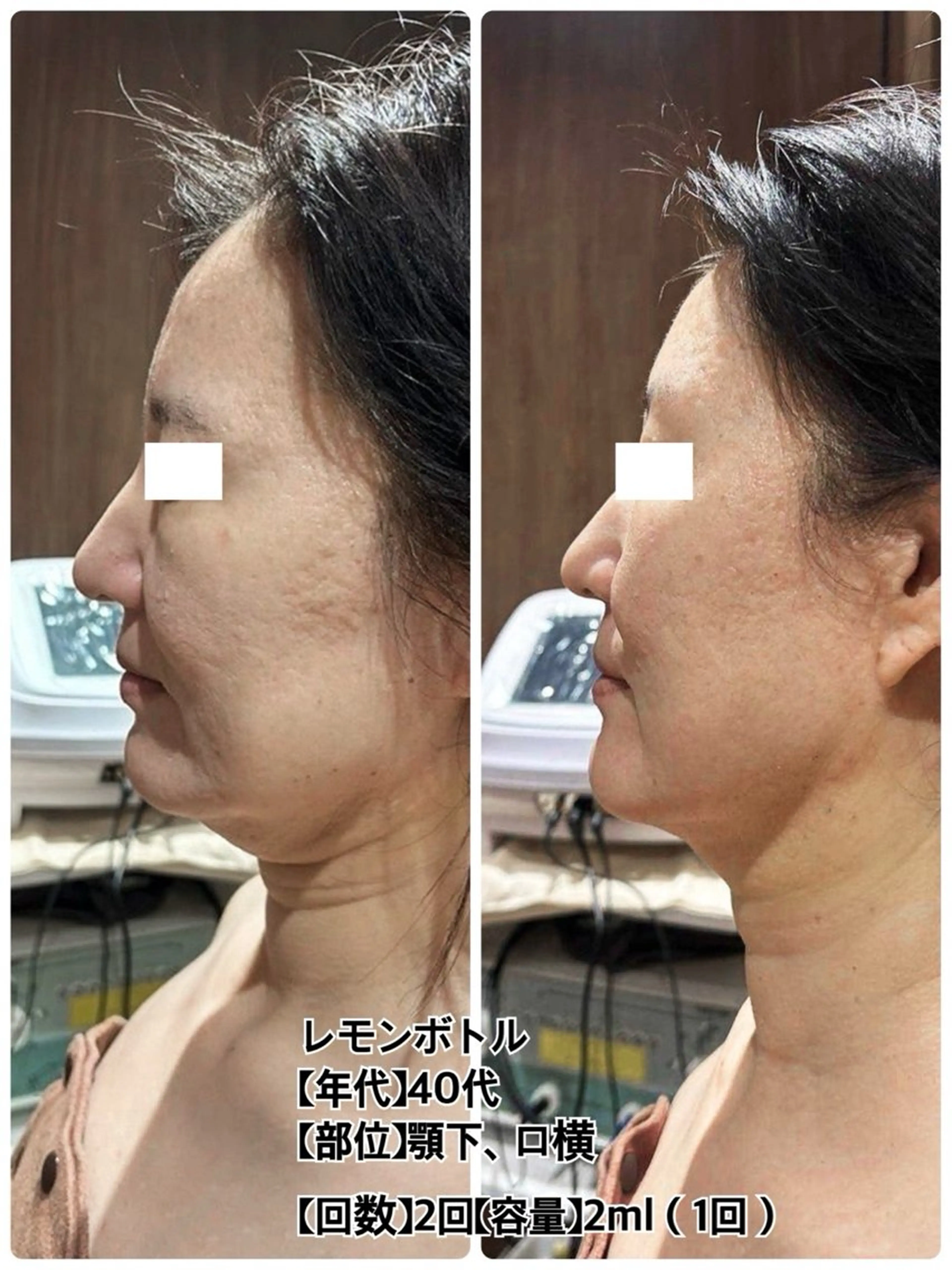 エステ 井上 静のエステ・リラクイメージ