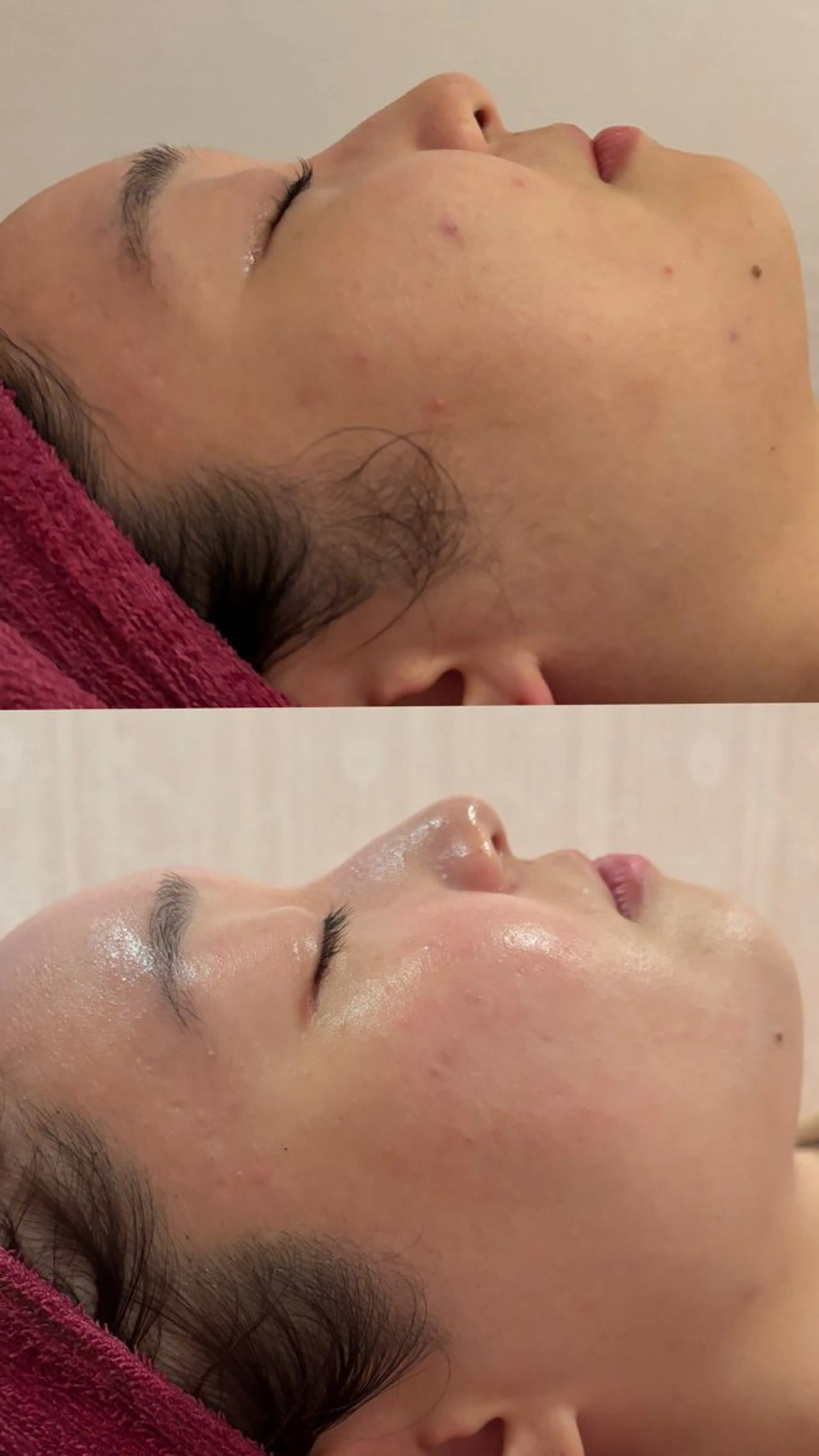 何を試しても実感出来なかった方必見！！【REVI-ルヴィ-1g】の写真