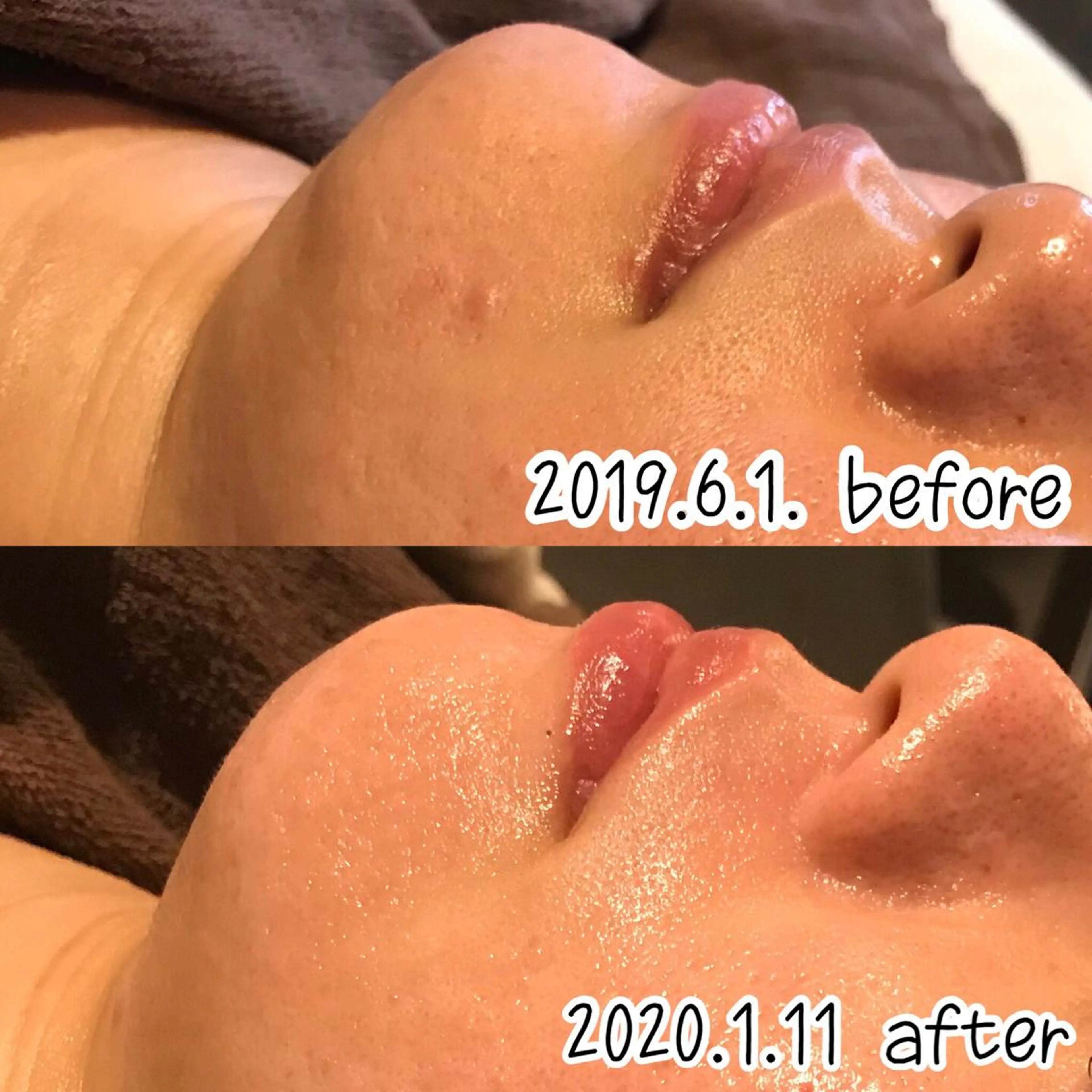 エステ 浜野 恵美のエステ・リラクイメージ