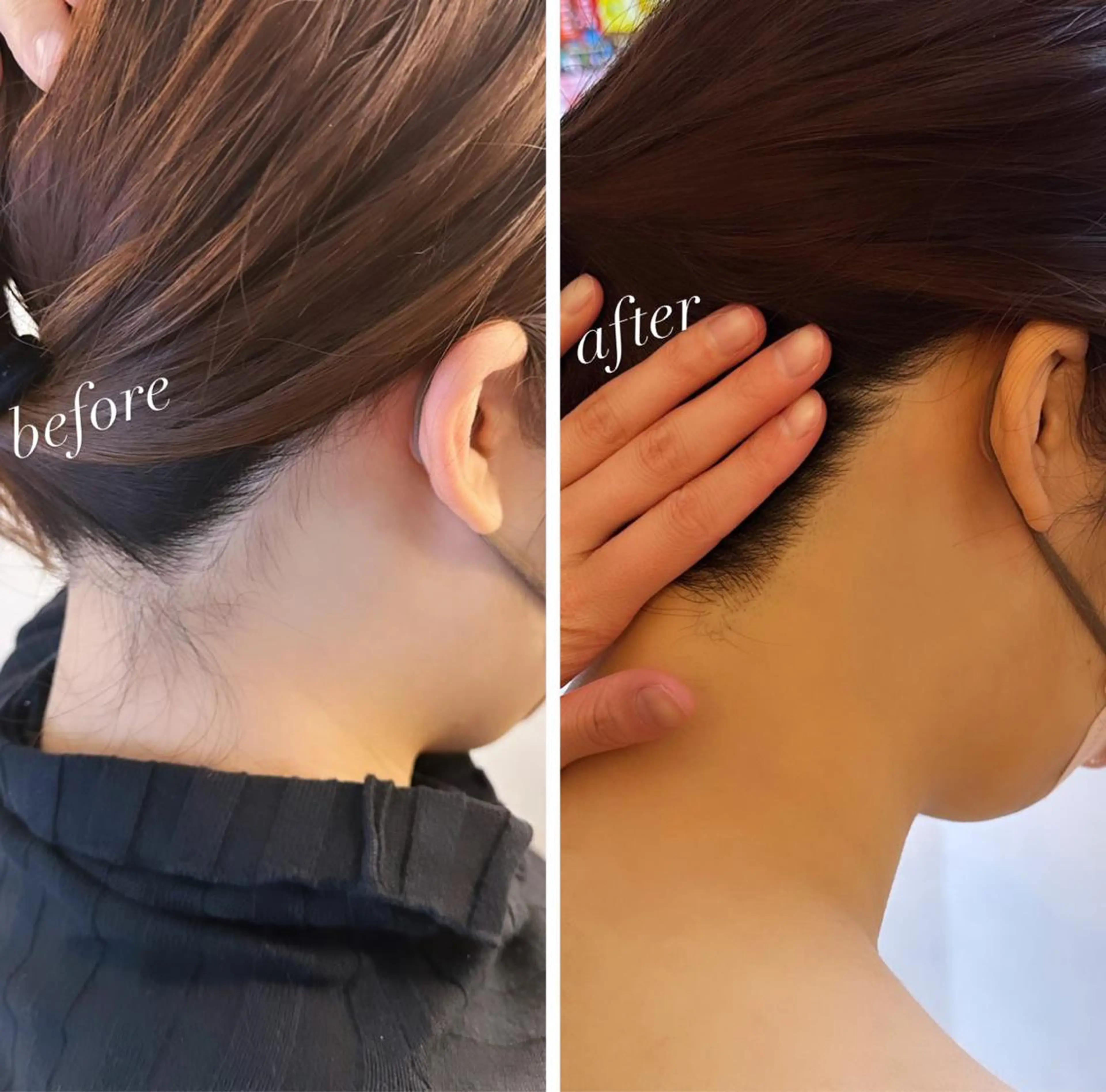 脱毛 うなじ脱毛/美肌脱毛 LABELのエステ・リラクイメージ