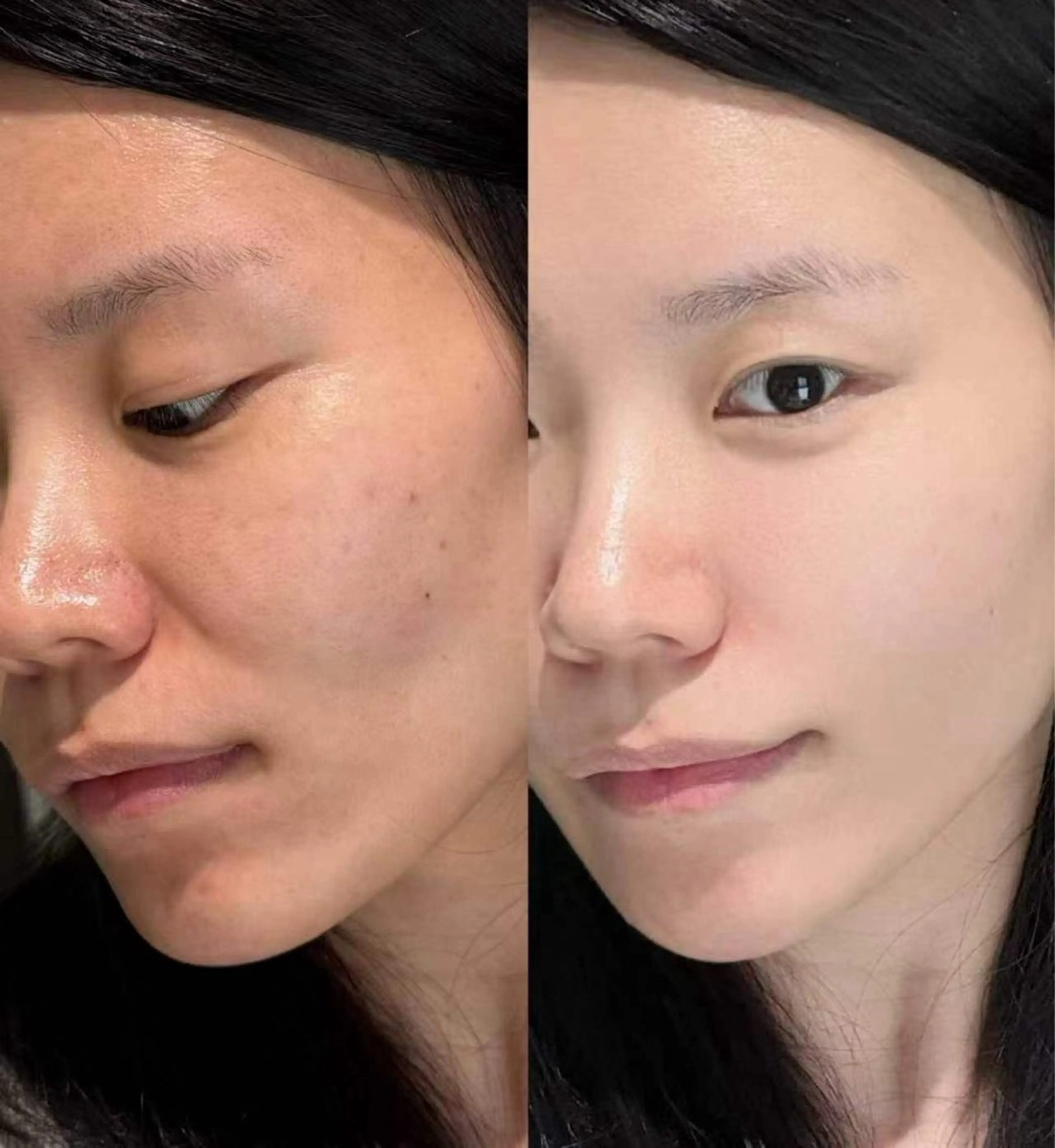 パーマ エステ aliaハイフ&水光ジェットサロン所属・aliaハーブ水光店 エステティシャン募集のエステ・リラクイメージ