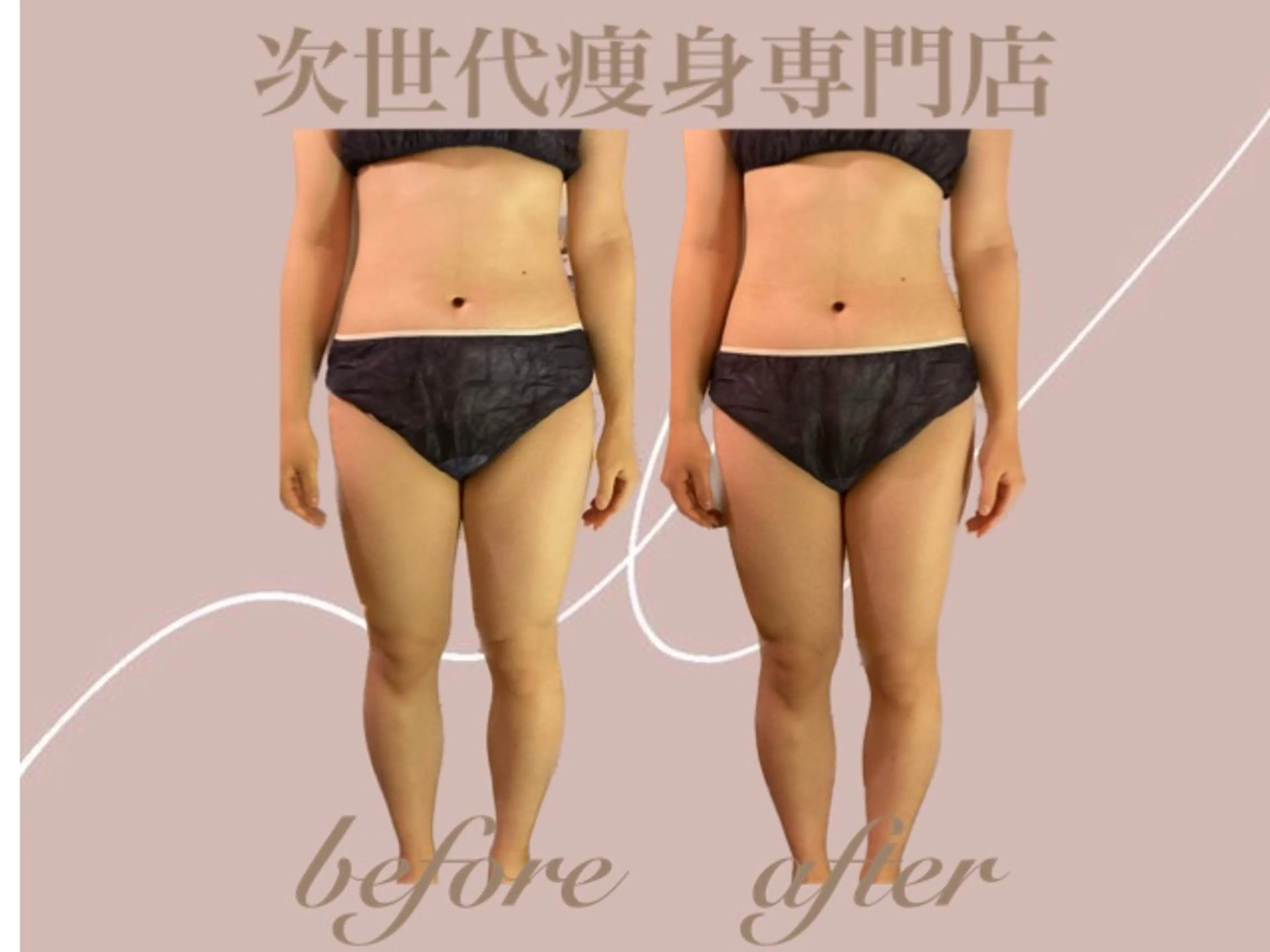 エステ 温活痩身サロン LILYのエステ・リラクイメージ